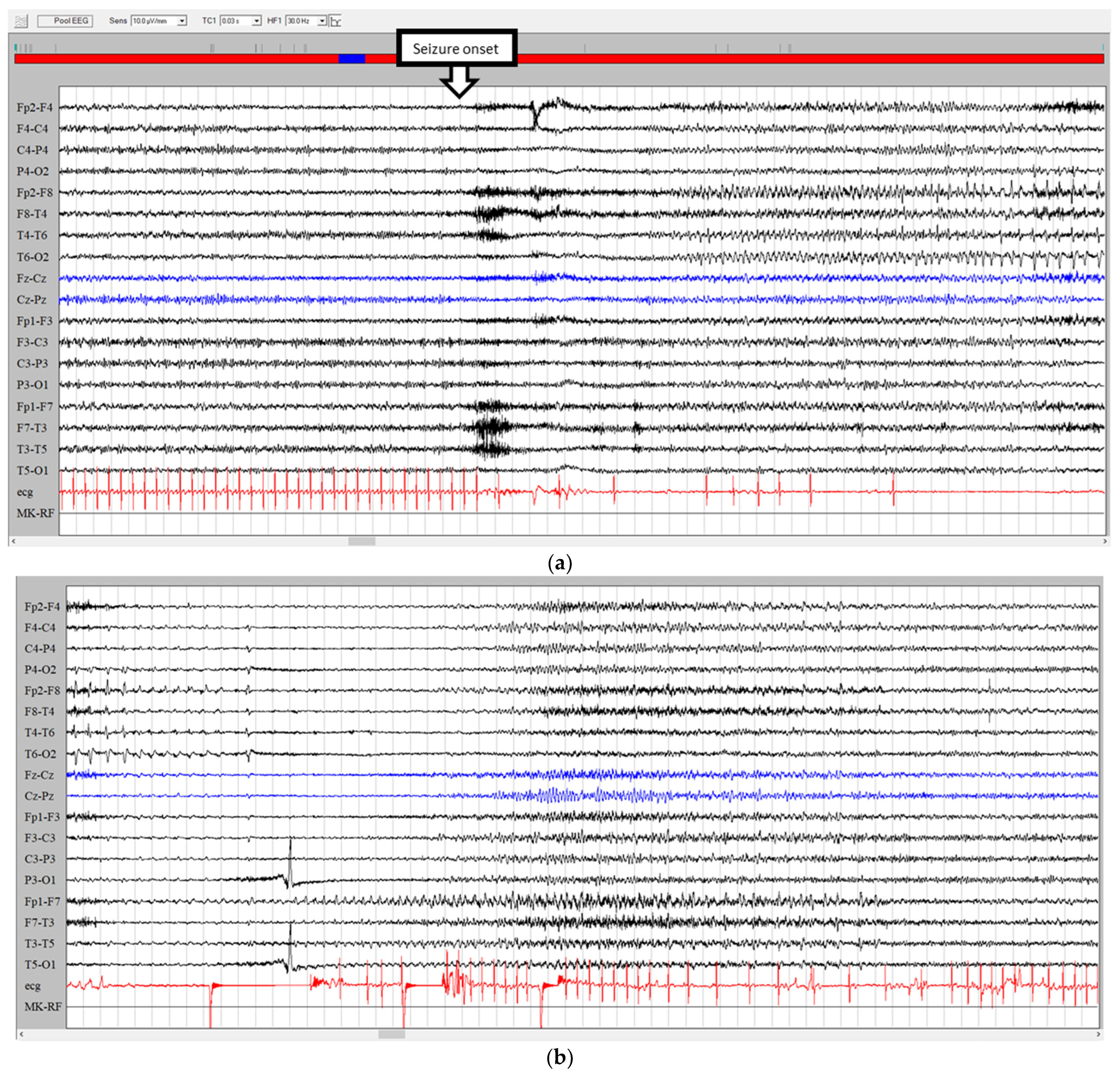 Jcm 12 05805 g003 Jcm 12 05805 g003