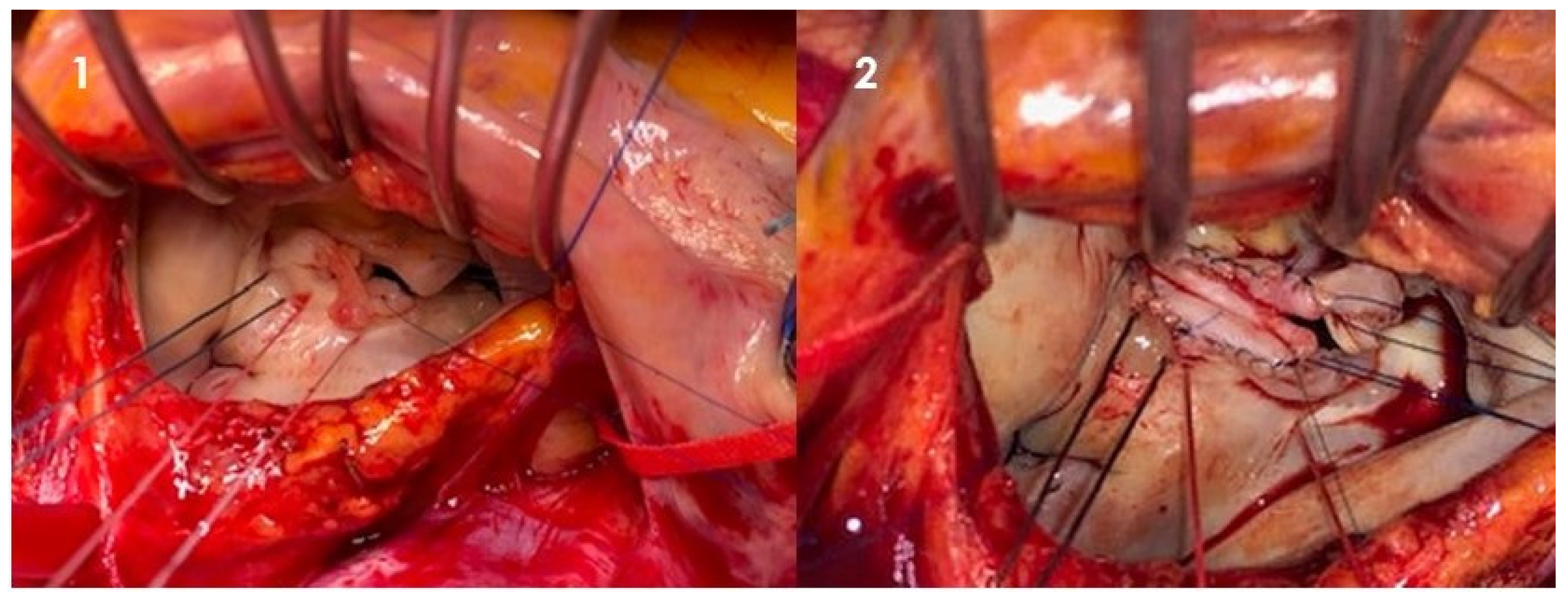 Jcm 12 05891 g001 Jcm 12 05891 g001