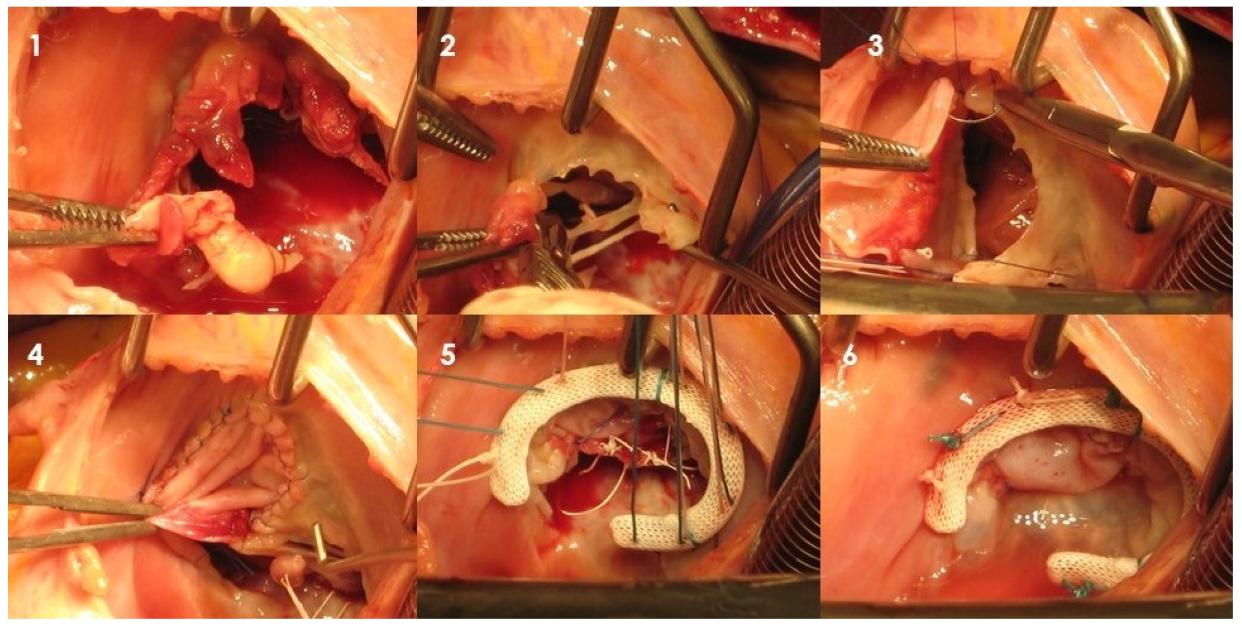 Jcm 12 05891 g002 Jcm 12 05891 g002