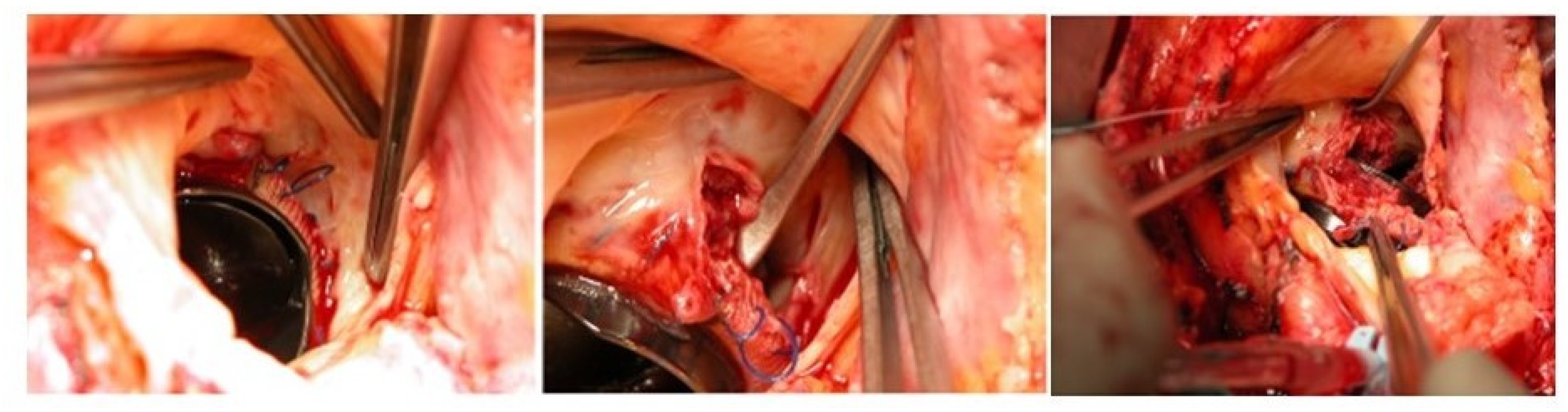 Jcm 12 05891 g003 Jcm 12 05891 g003