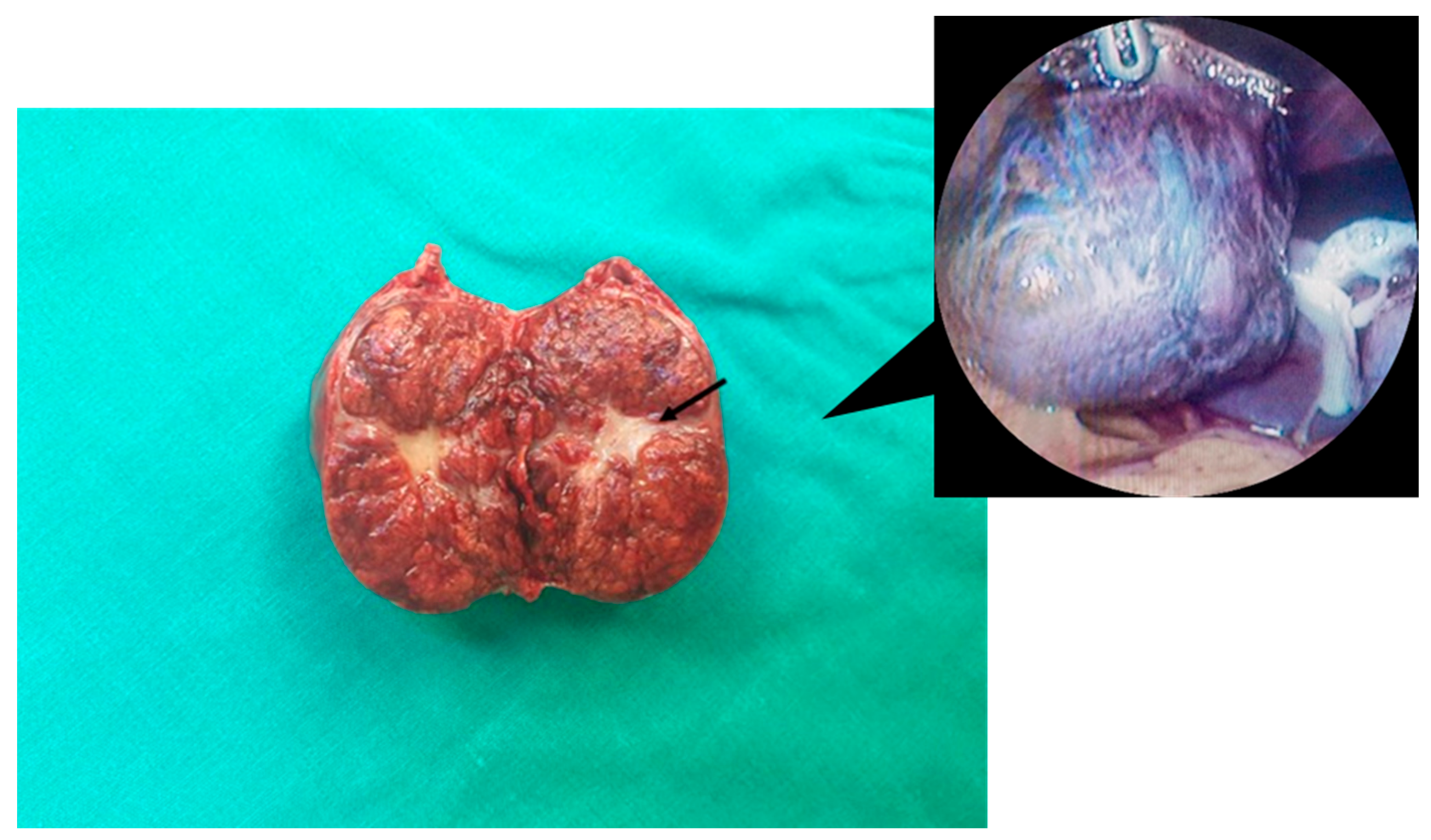 Jcm 12 06034 g002 Jcm 12 06034 g002