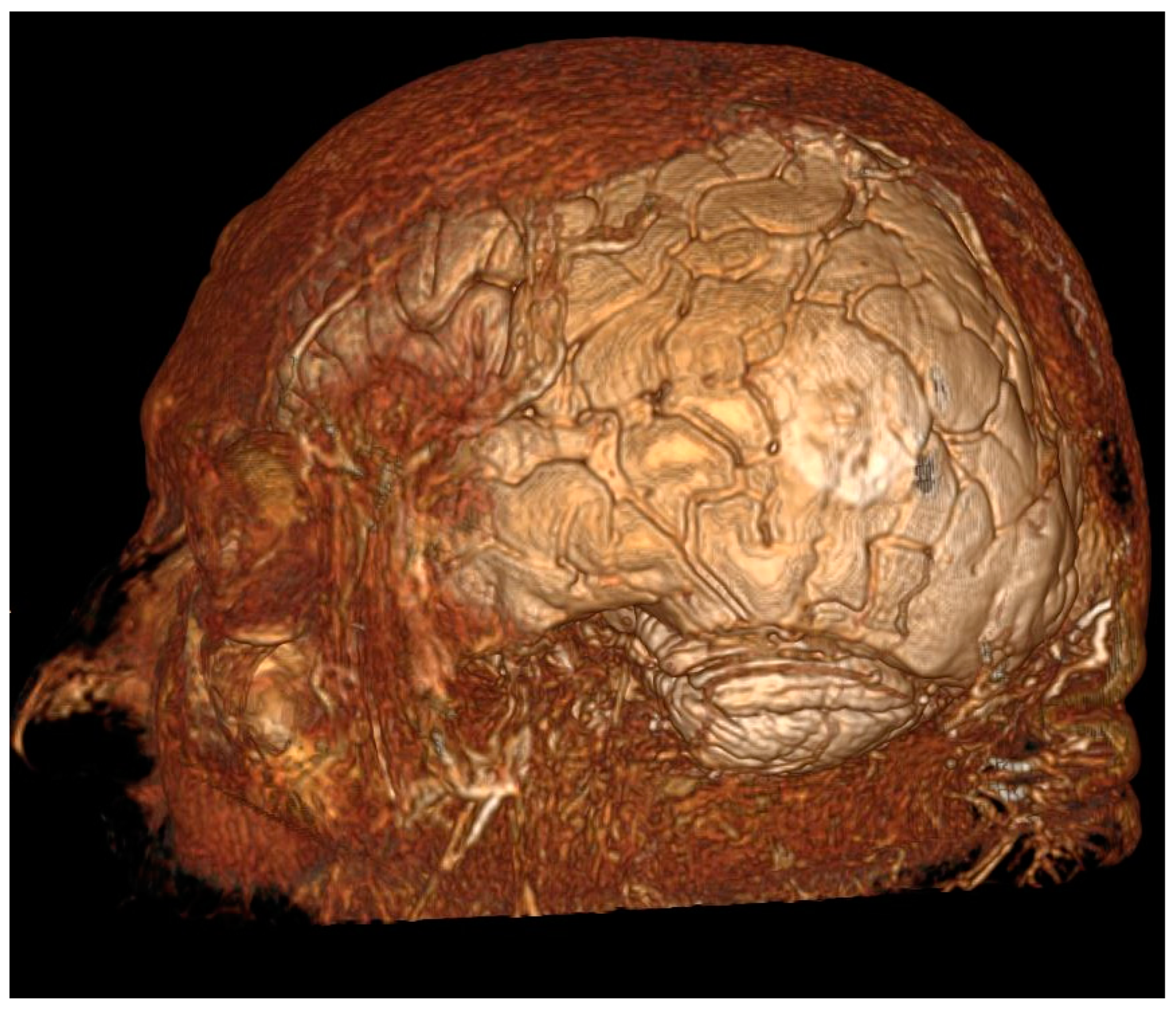 Jcm 12 06086 g001 Jcm 12 06086 g001