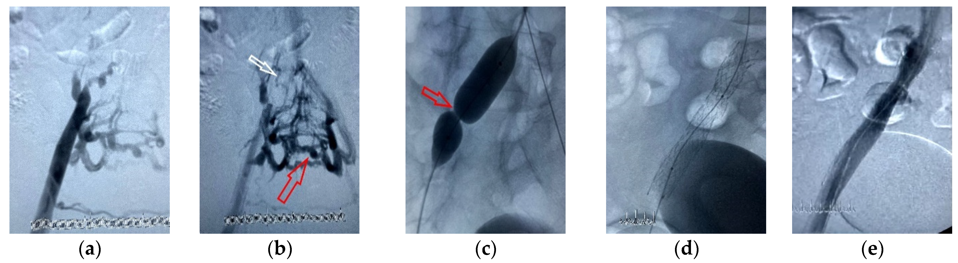 Jcm 12 06153 g008 Jcm 12 06153 g008
