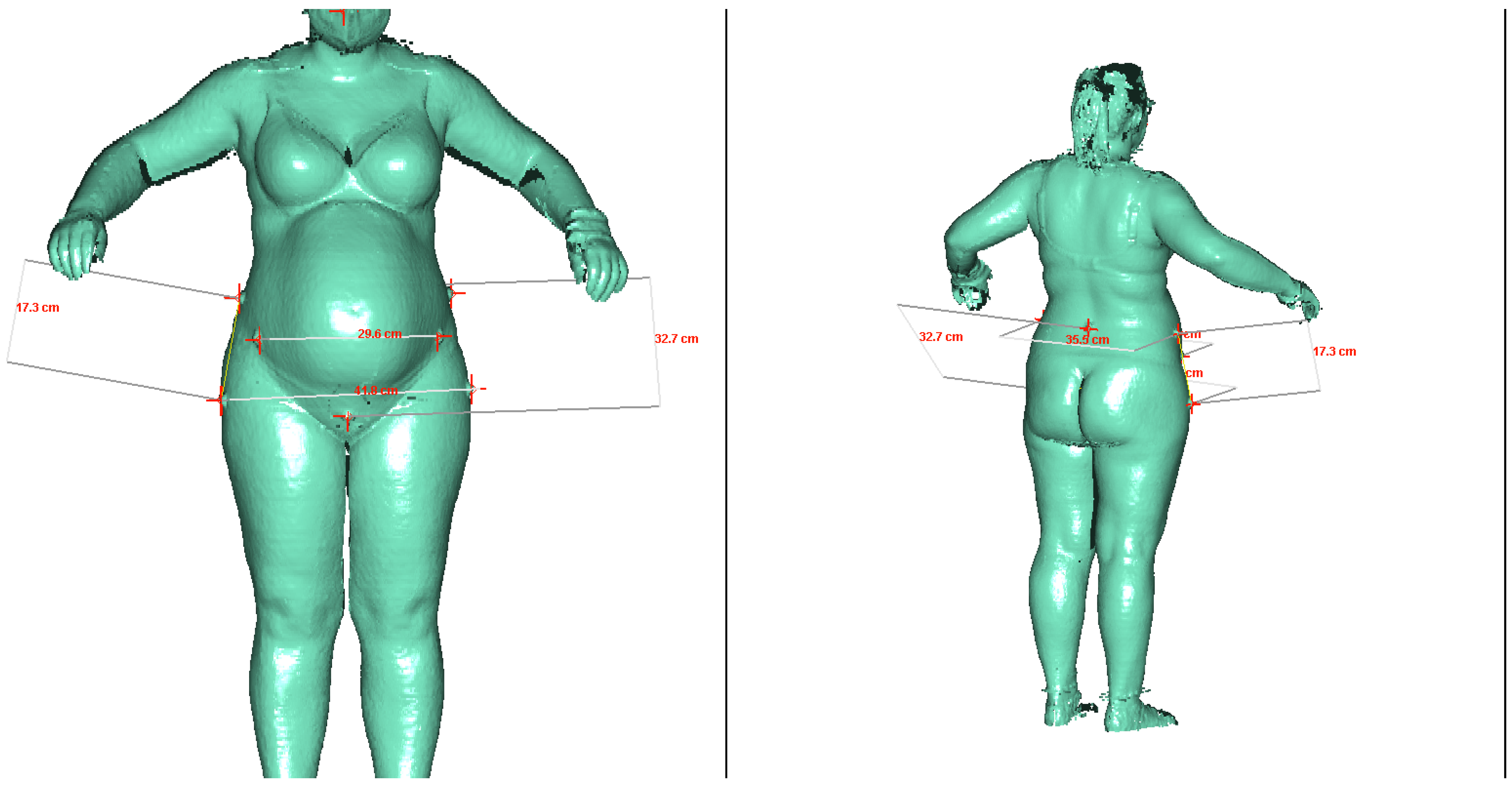 Vitronic VITUS 3D body Scanner review - Body scanning 3D scanner