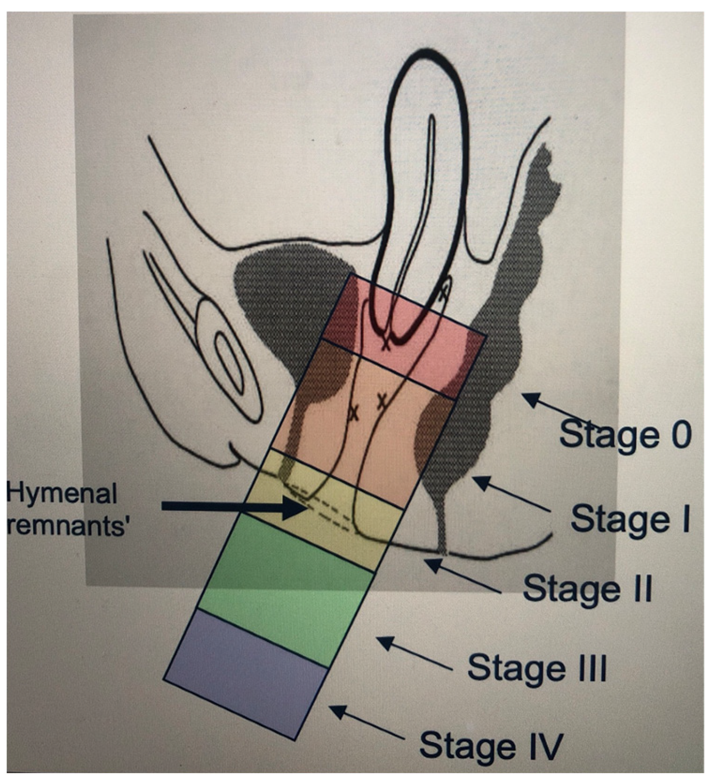 hymenal K: Vulvar pain and vulvodynia - Vulvovaginal Disorders