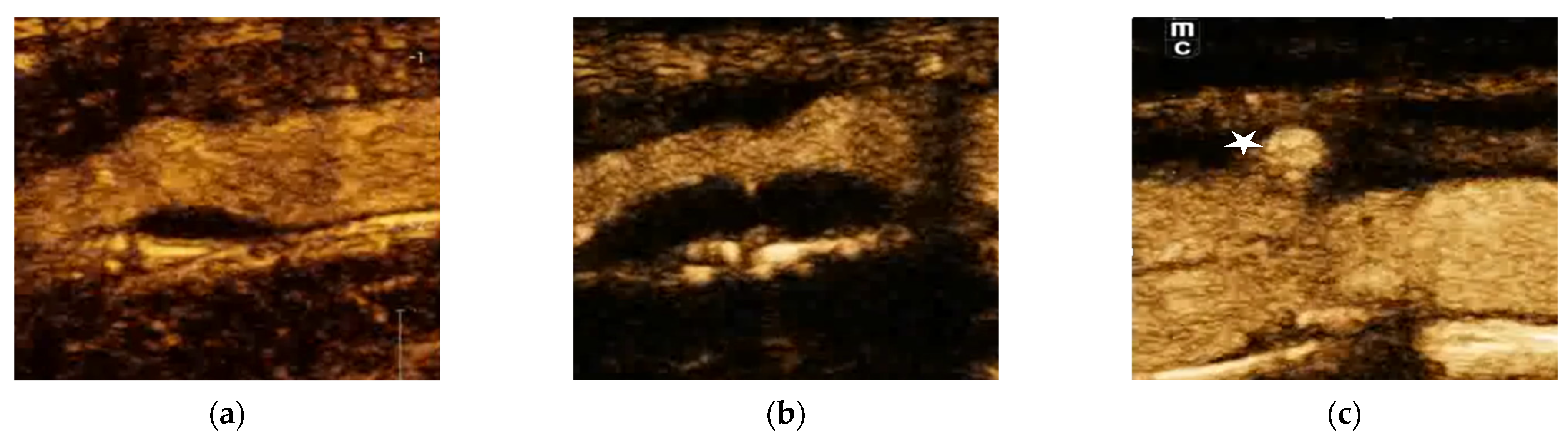 Jcm 12 06416 g003 Jcm 12 06416 g003