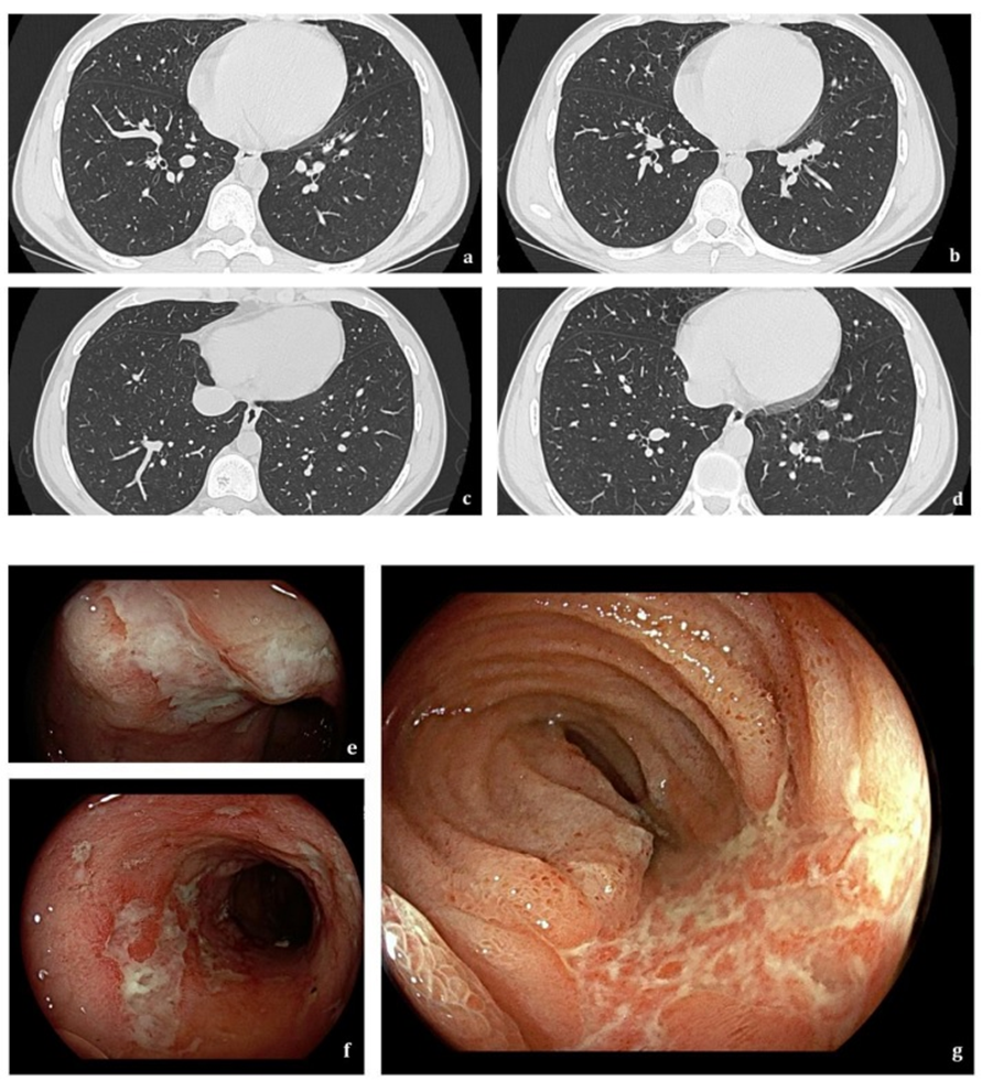 Jcm 12 06419 g002 Jcm 12 06419 g002