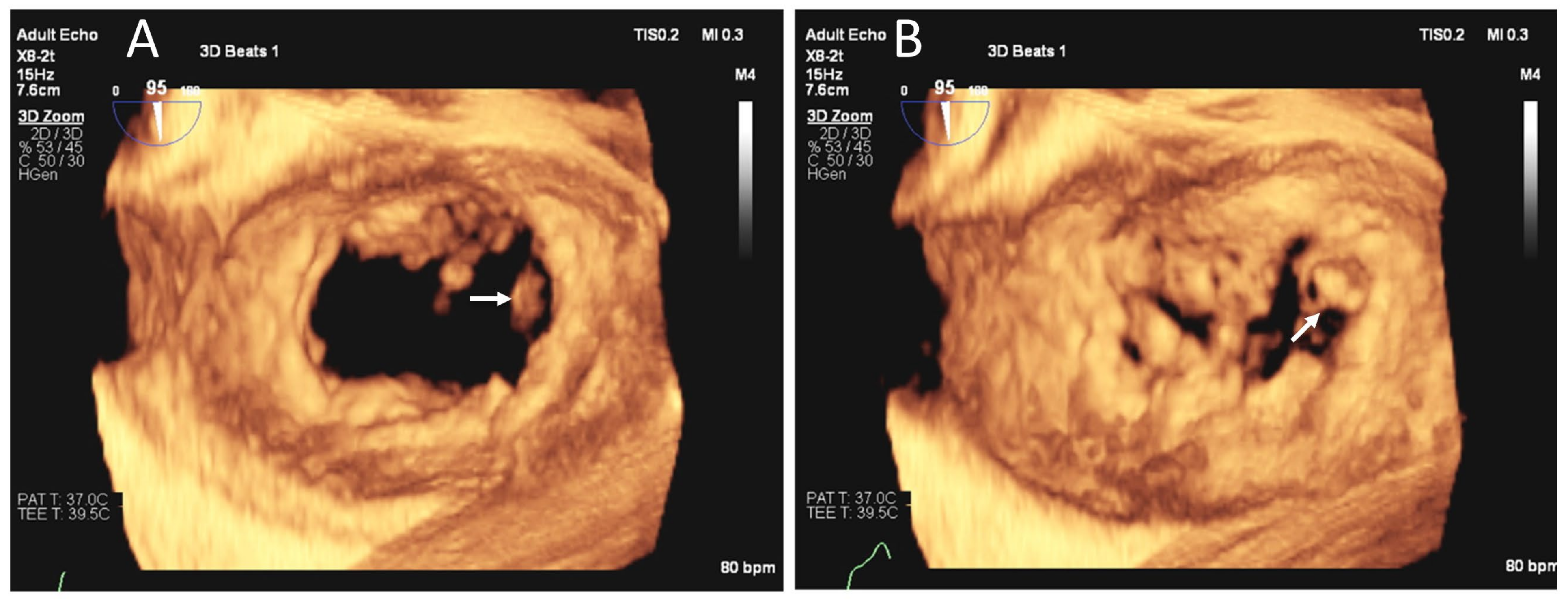 Jcm 12 06474 g004 Jcm 12 06474 g004