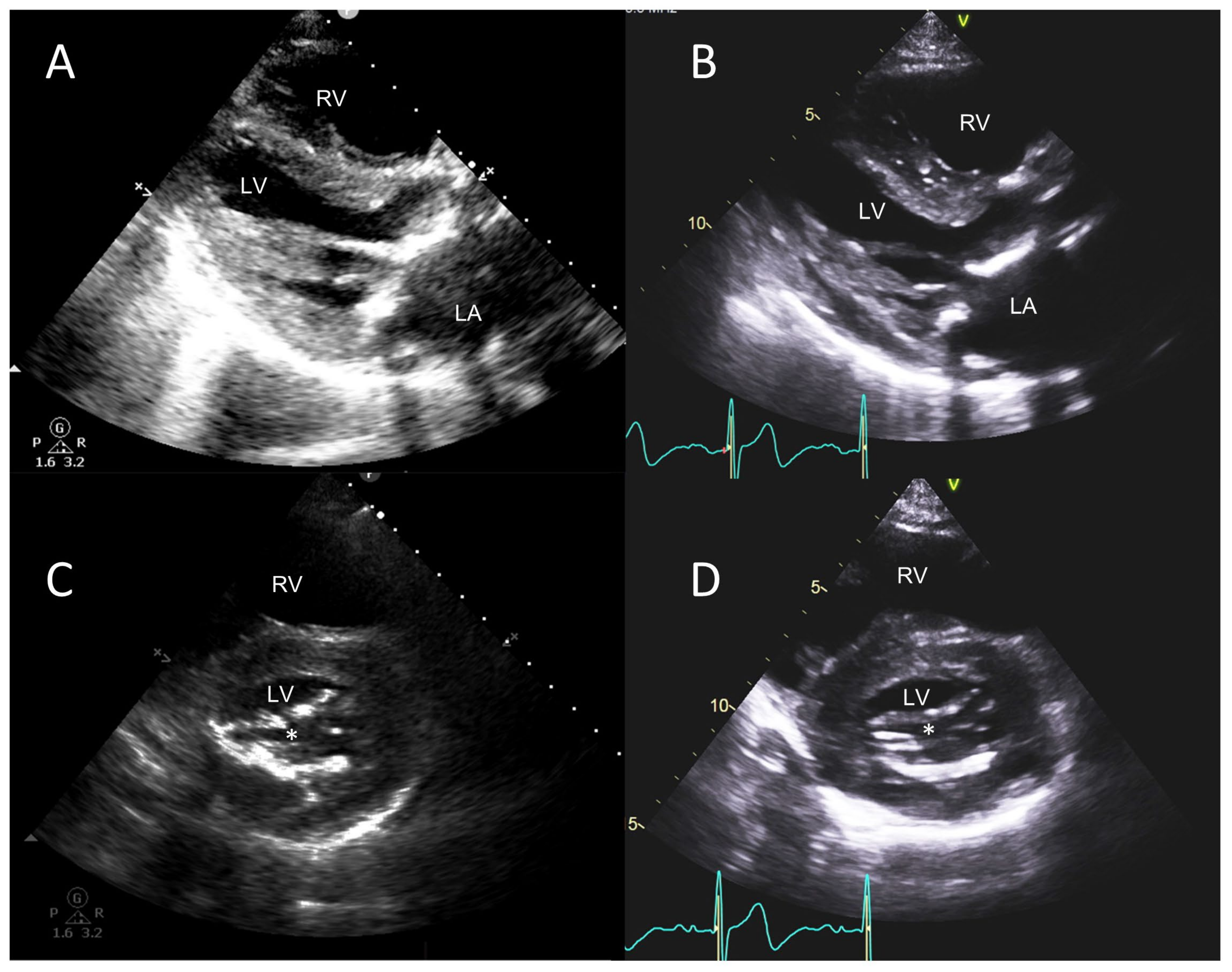 Jcm 12 06474 g006 Jcm 12 06474 g006