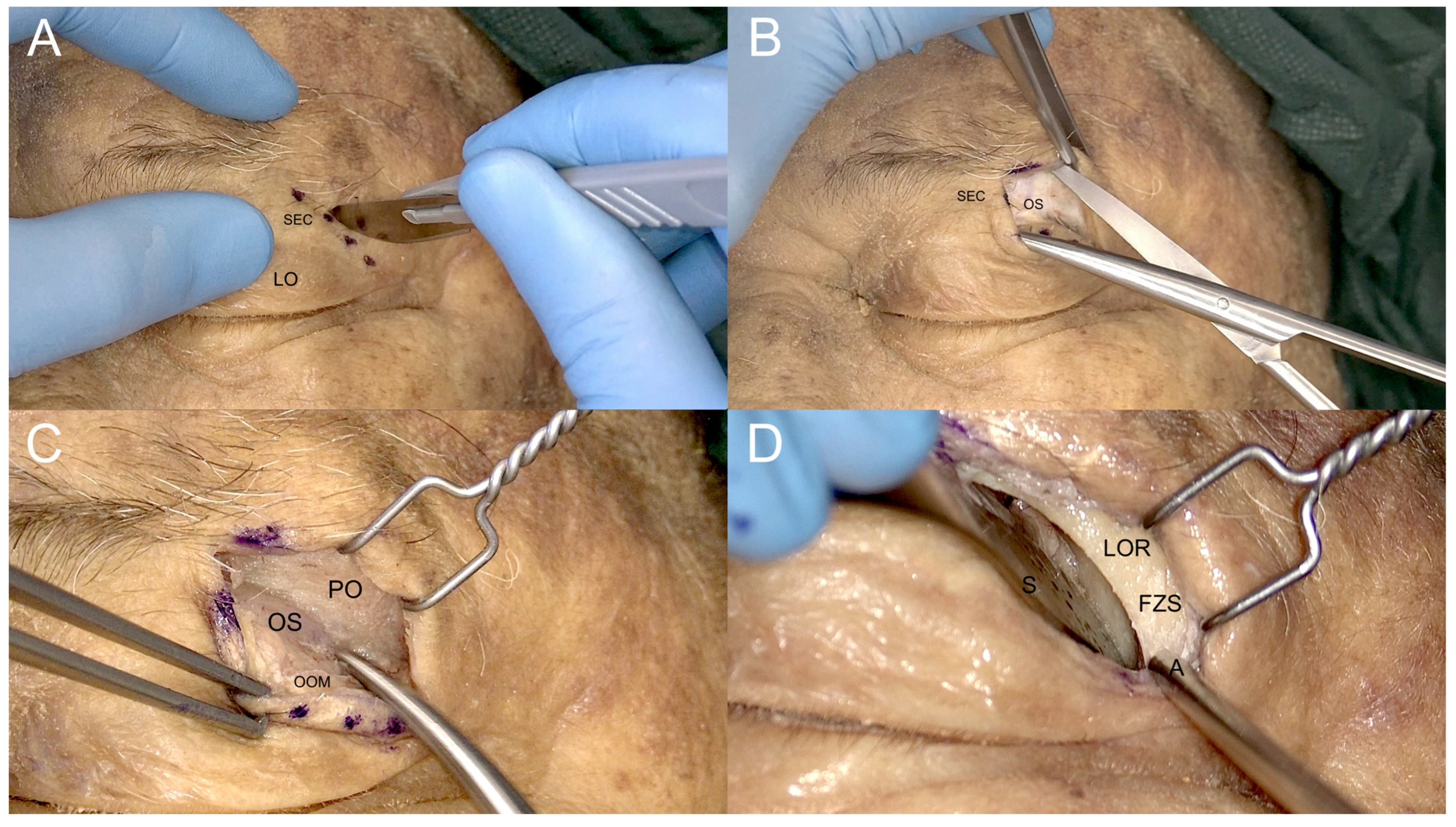 Jcm 12 06484 g006 Jcm 12 06484 g006