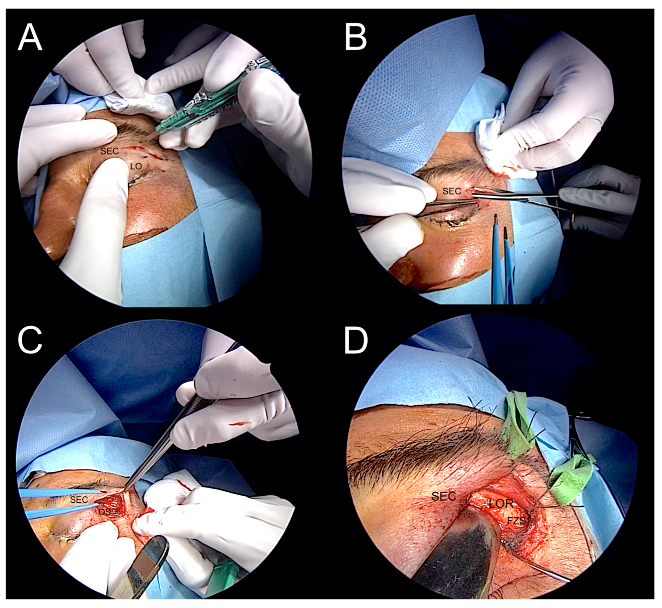 Jcm 12 06484 g009 Jcm 12 06484 g009