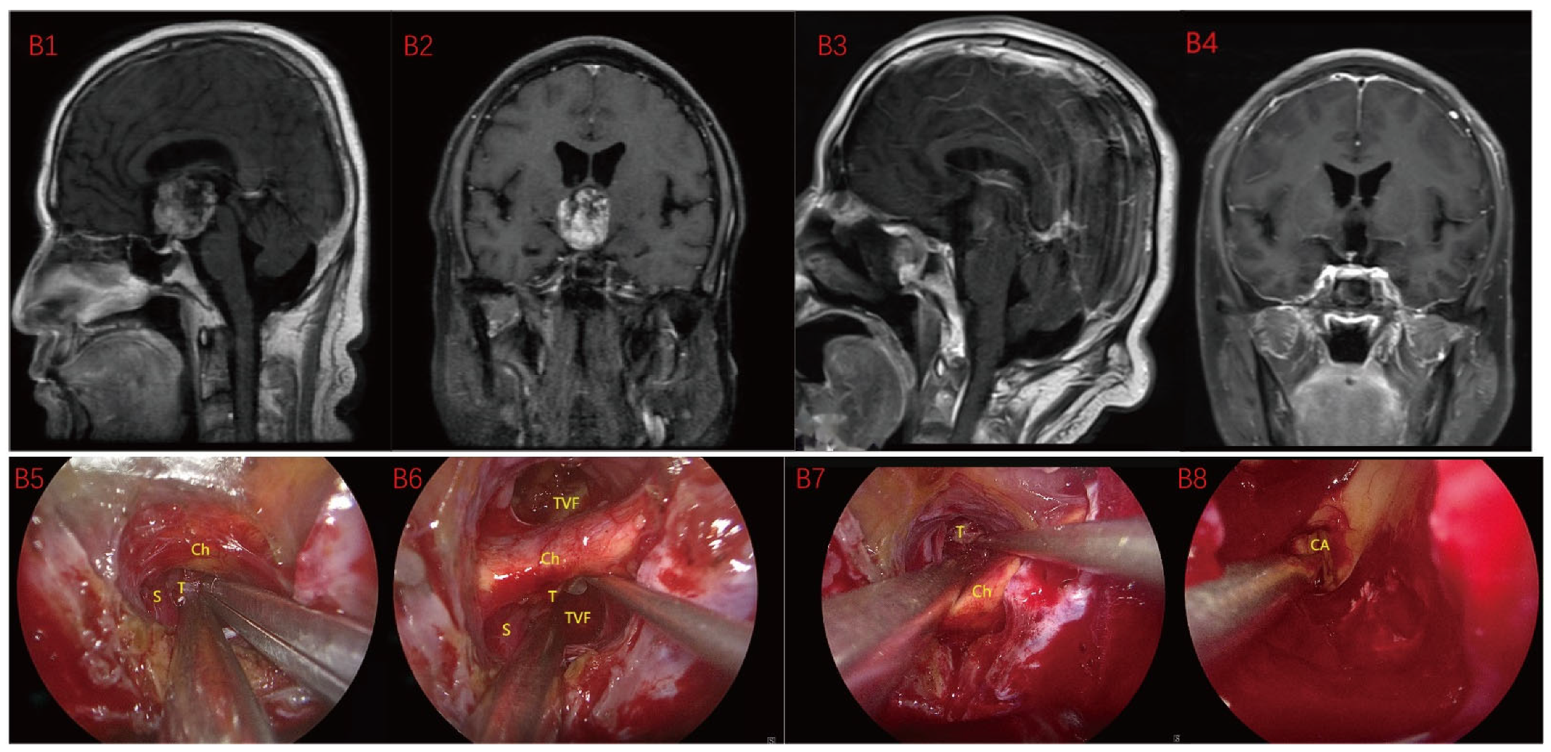 【裁断済】小児神経の画像診断 = Diagnostic Imaging of I 小児神経の画像診断 = Diagnostic Imaging of Infan… 健康・医学