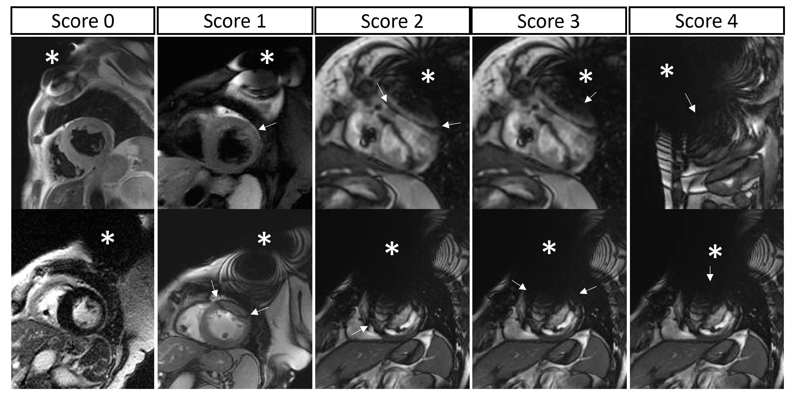 Cardiovascular Magnetic Resonance in Patients with Cardiac