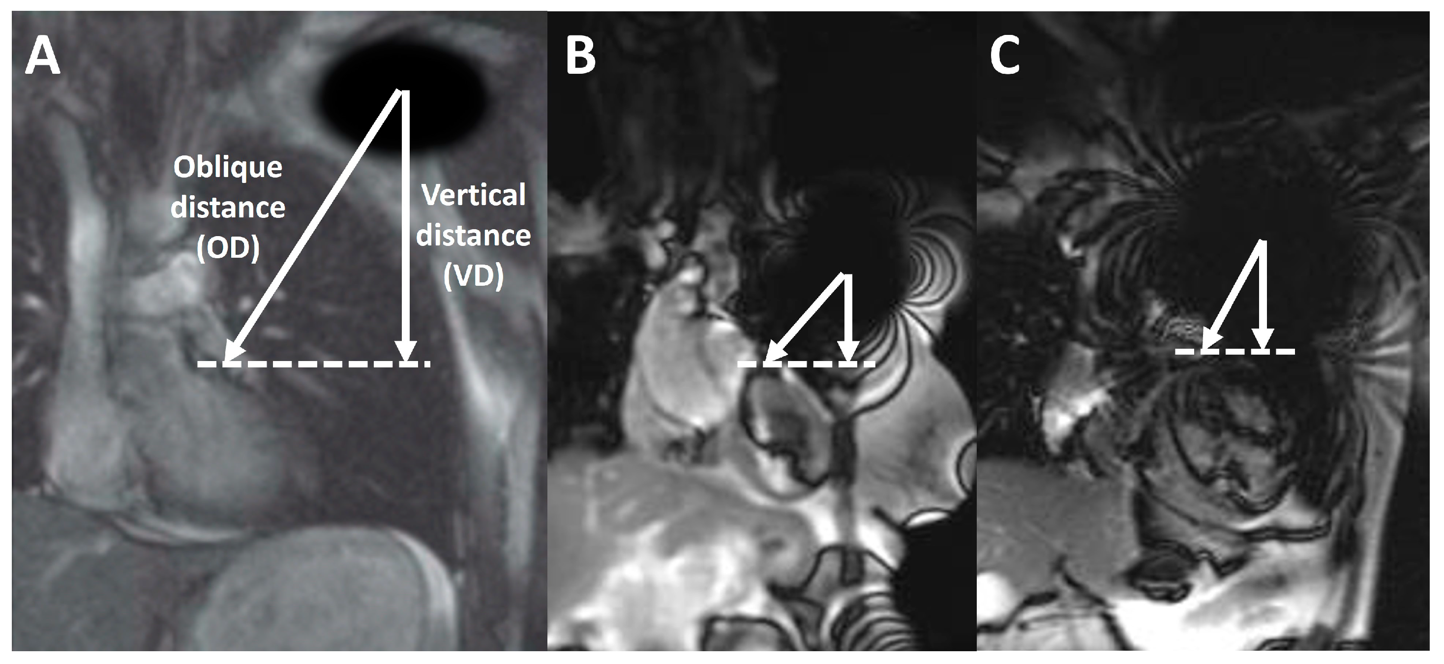Cardiovascular Magnetic Resonance in Patients with Cardiac