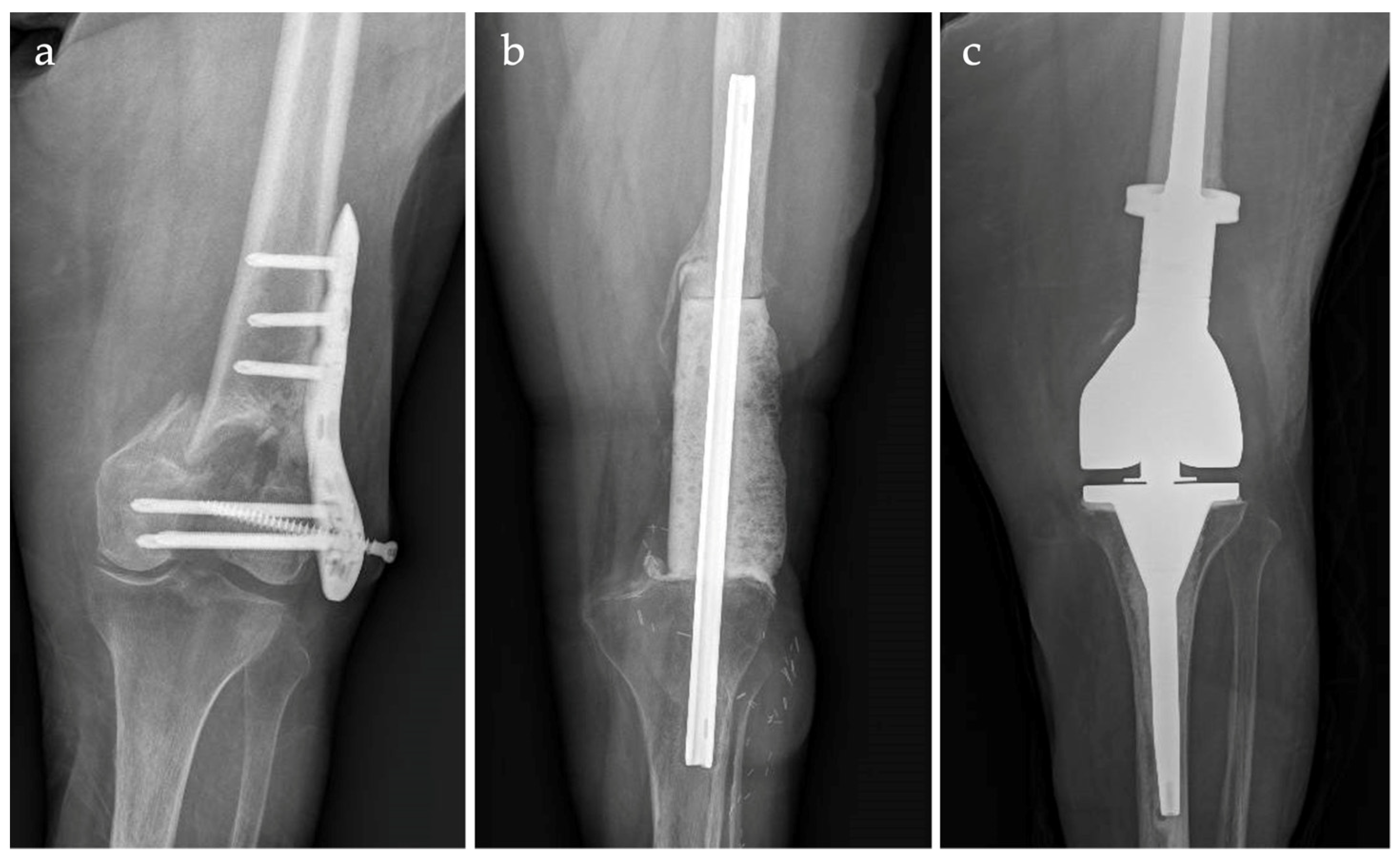 Jcm 12 06679 g002 Jcm 12 06679 g002