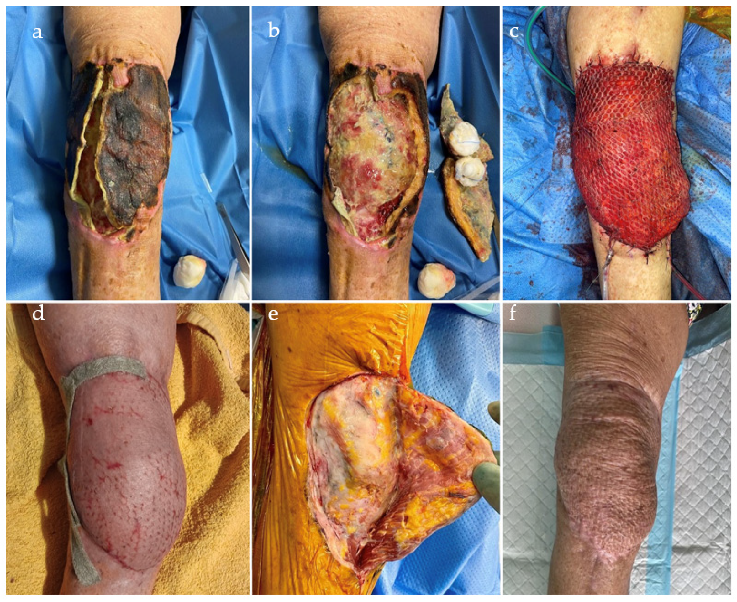 Jcm 12 06679 g003 Jcm 12 06679 g003