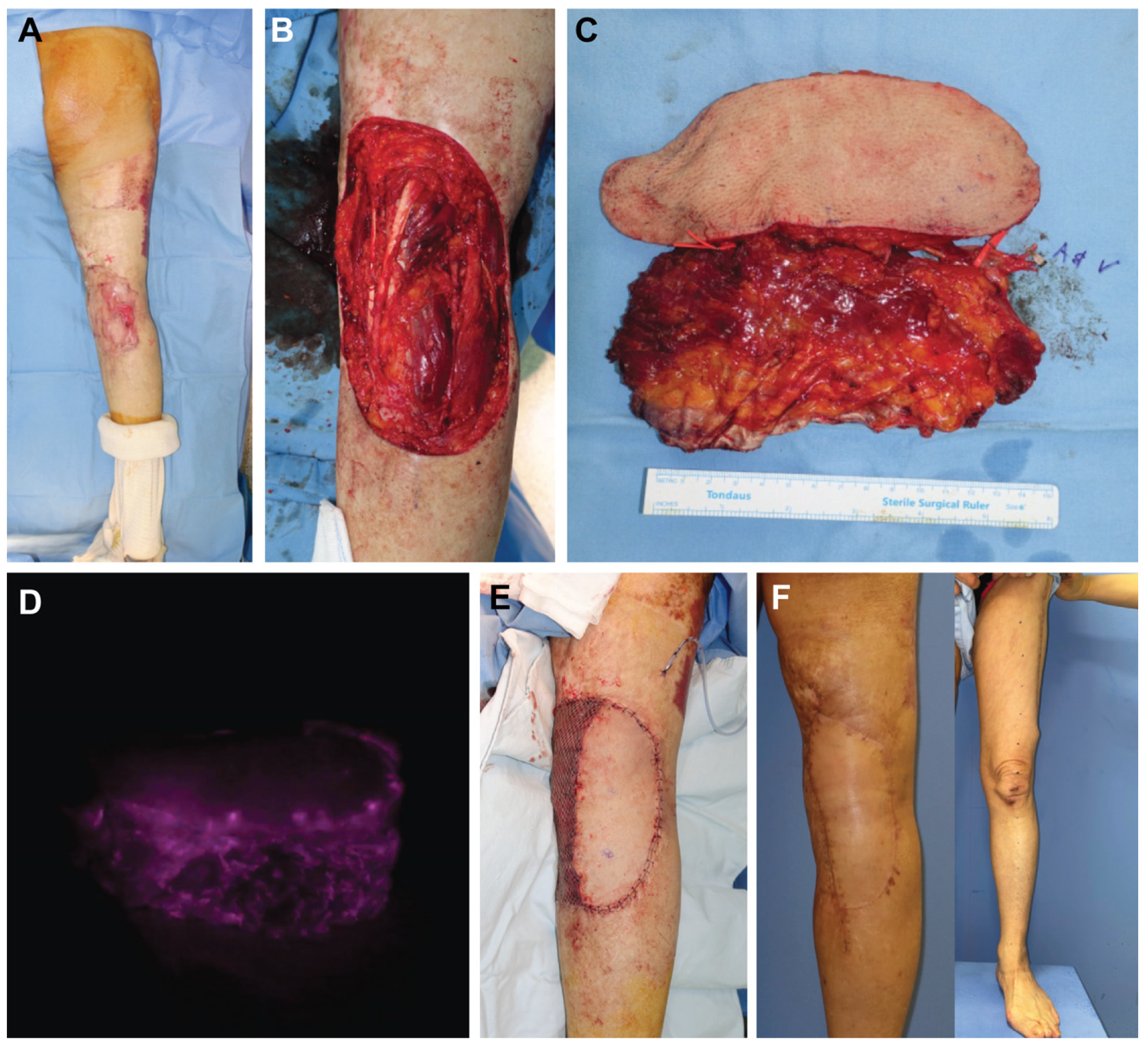 Jcm 12 06723 g003 Jcm 12 06723 g003