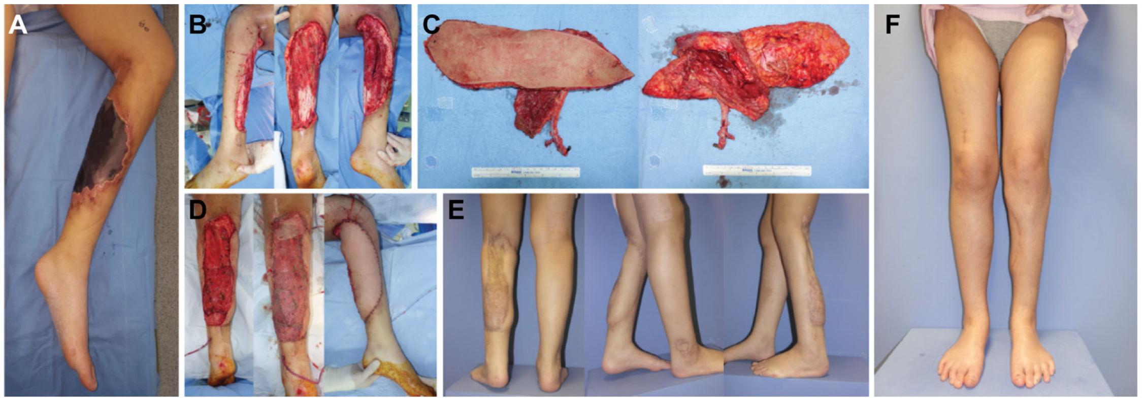 Jcm 12 06723 g004 Jcm 12 06723 g004