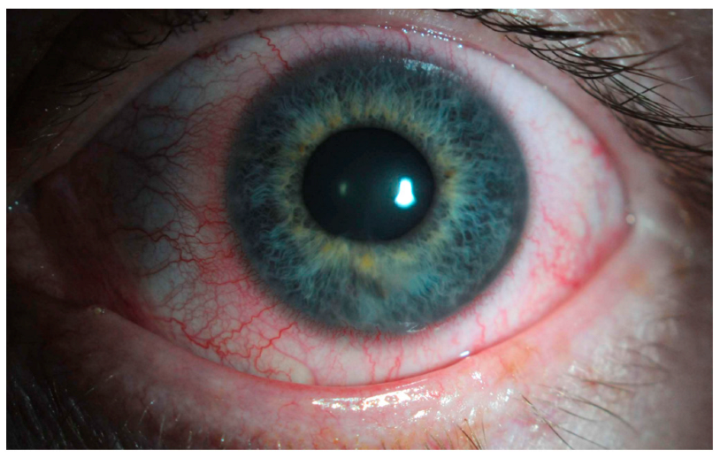 Jcm 12 06736 g002 Jcm 12 06736 g002