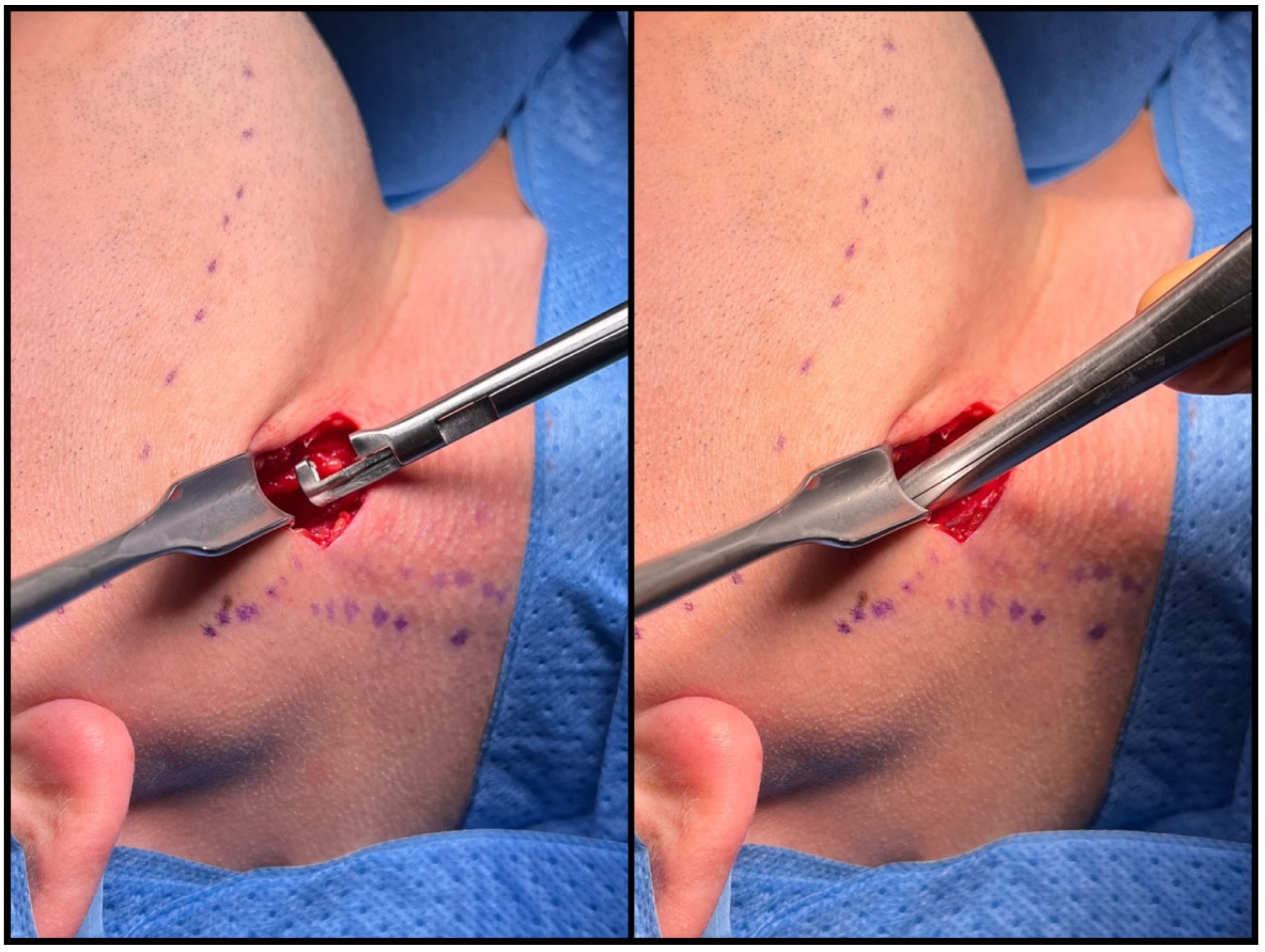 Jcm 12 06763 g006 Jcm 12 06763 g006