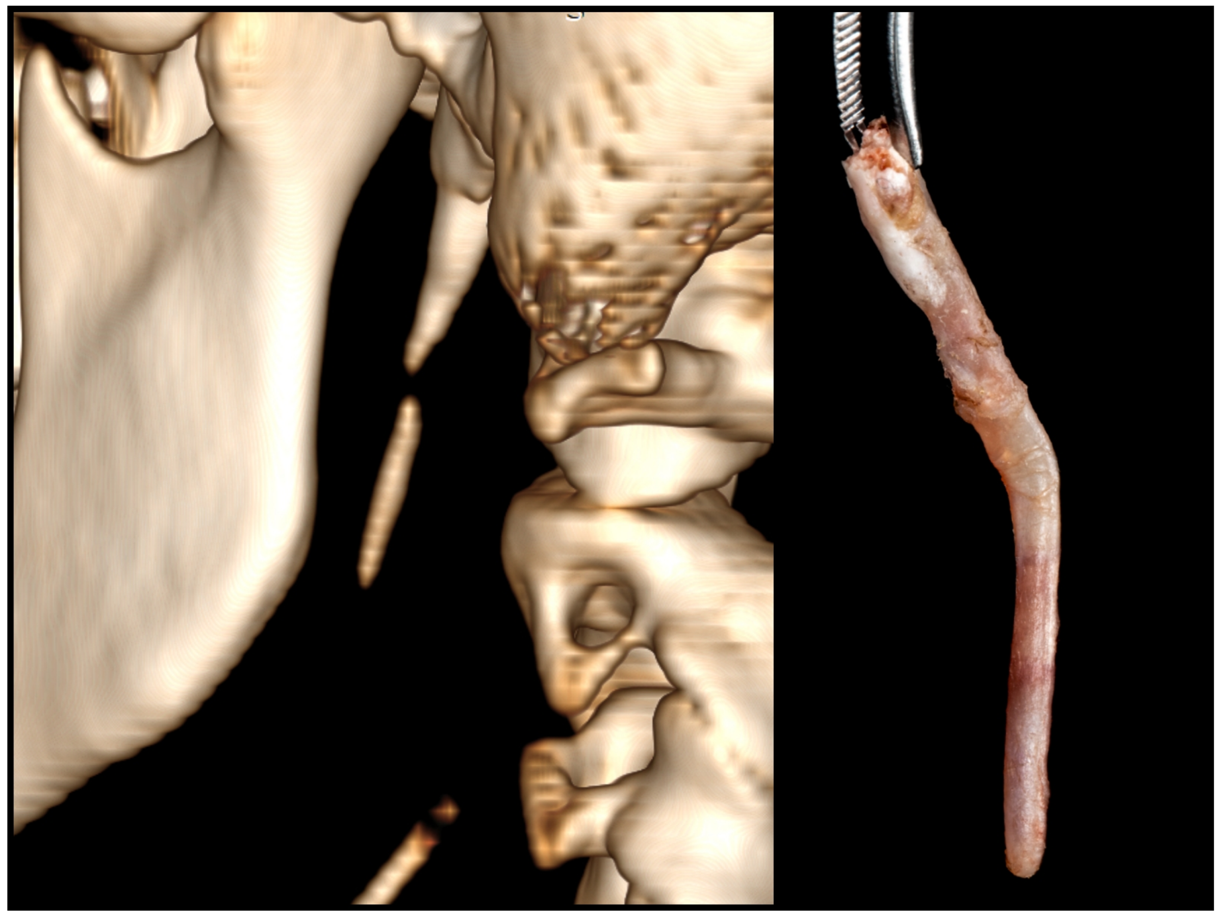 Jcm 12 06763 g011 Jcm 12 06763 g011