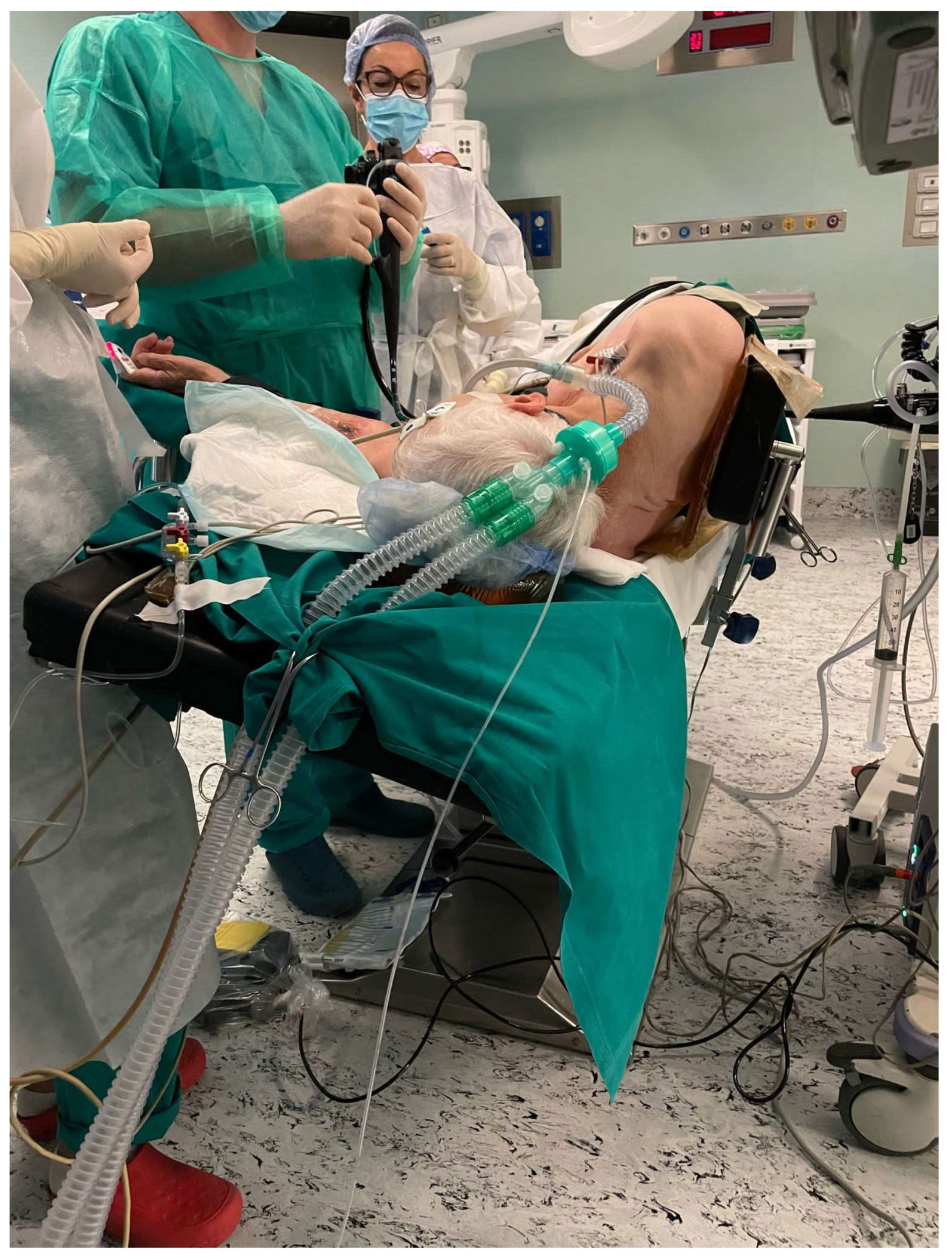 Patient Position in Operative Endoscopy