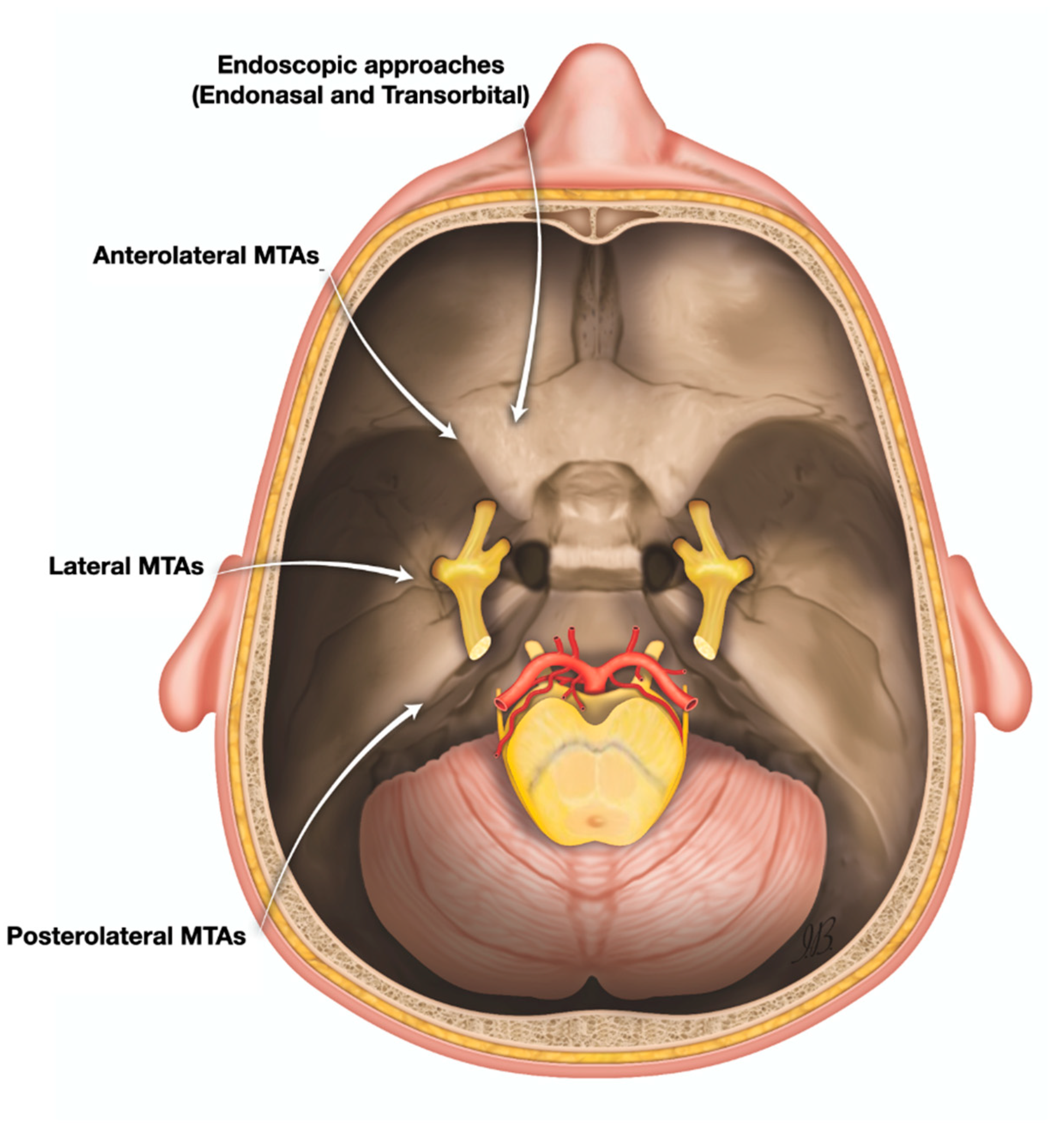 Diagrammatic representation of the normal anatomy of the mandibular