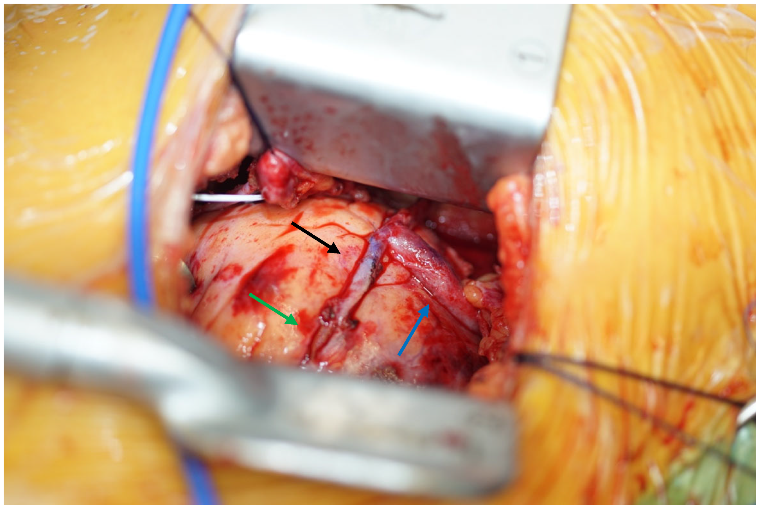 Jcm 12 06890 g002 Jcm 12 06890 g002