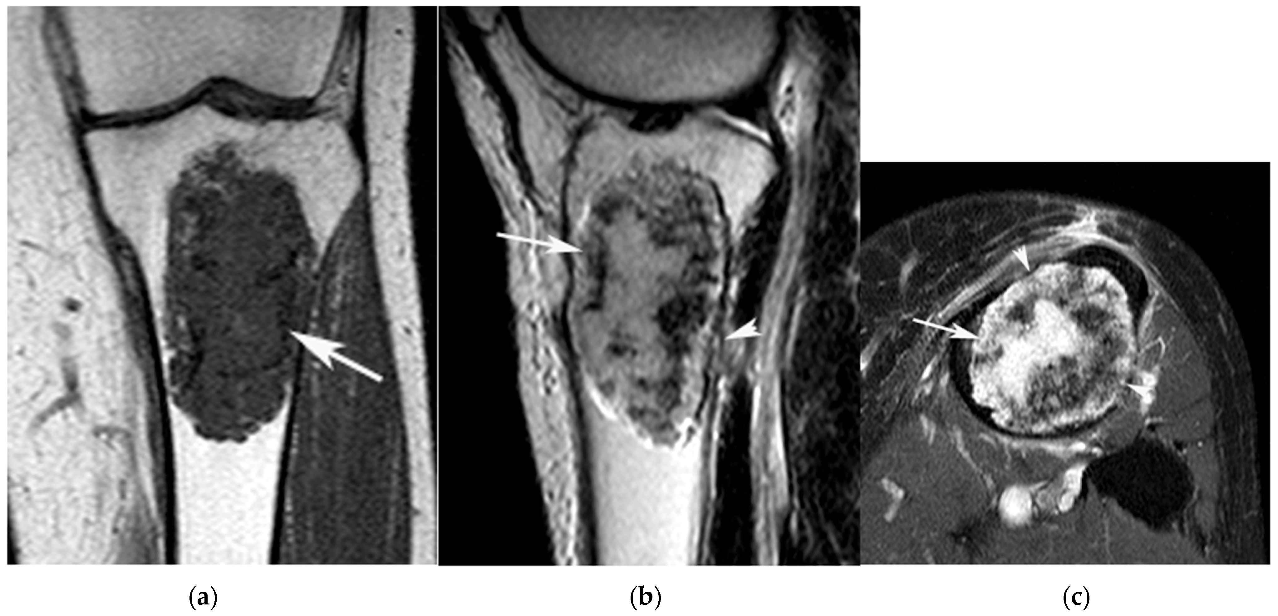 Jcm 12 06905 g002 Jcm 12 06905 g002