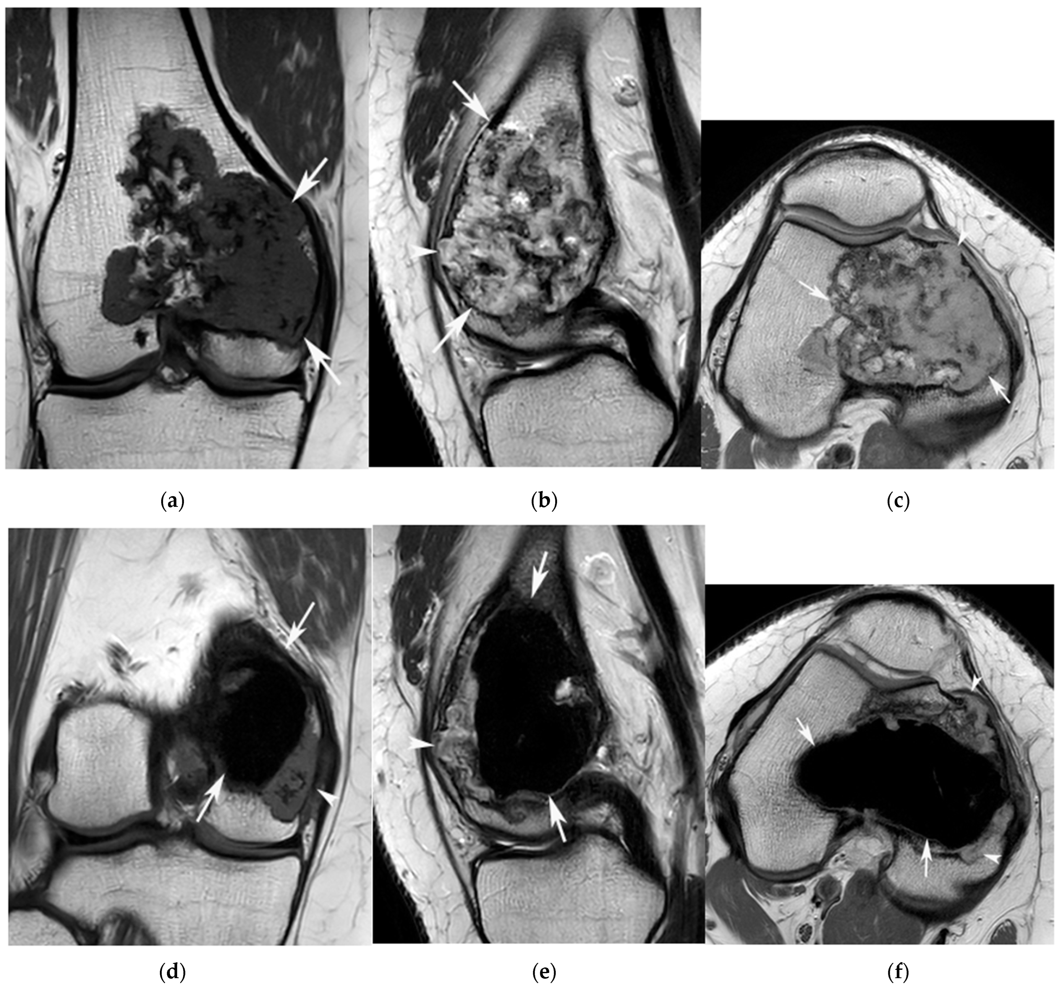 Jcm 12 06905 g005 Jcm 12 06905 g005