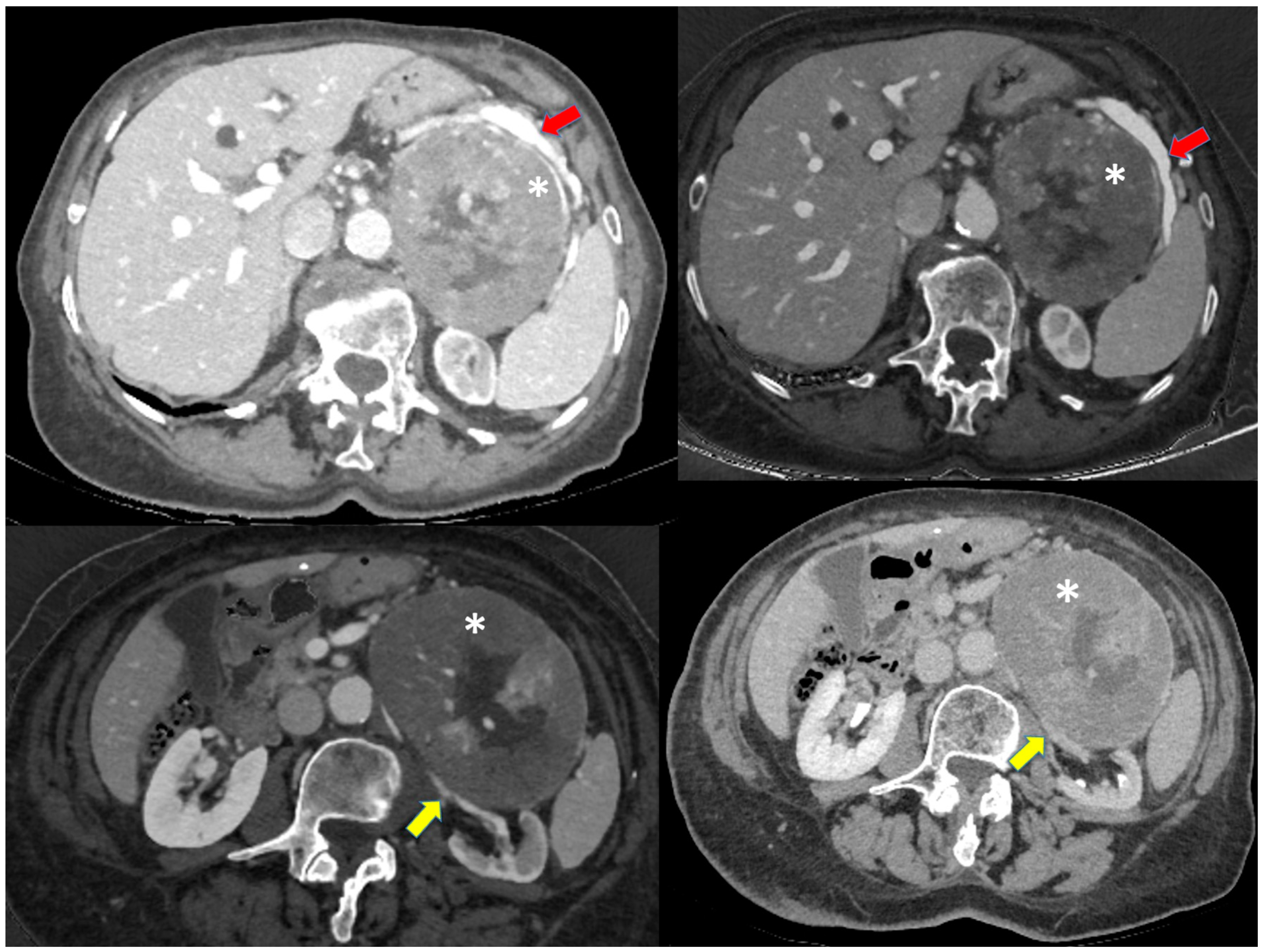 Jcm 12 06925 g001 Jcm 12 06925 g001