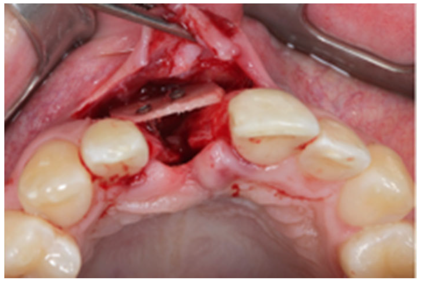 Jcm 12 07013 g002 Jcm 12 07013 g002