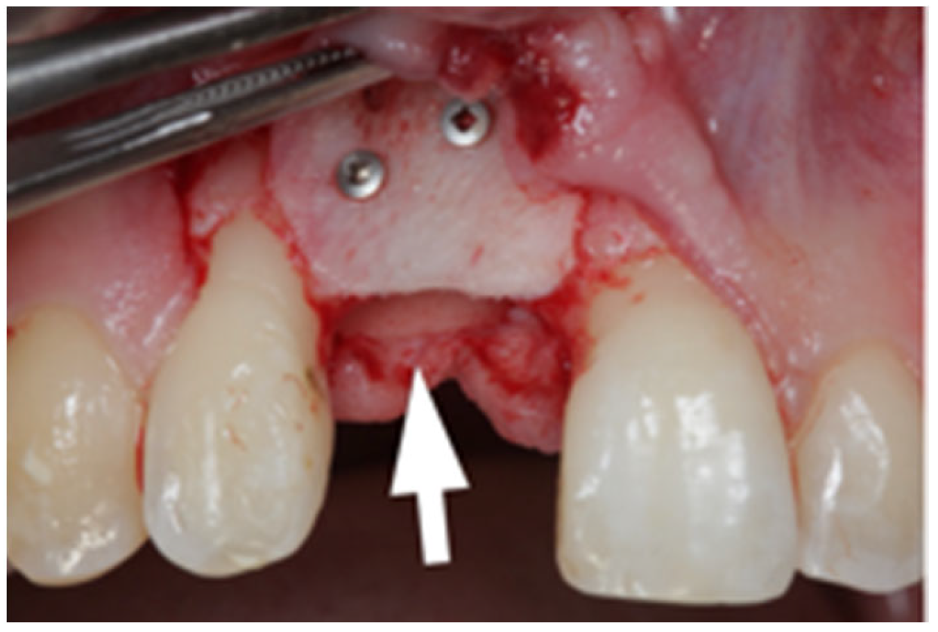Jcm 12 07013 g003 Jcm 12 07013 g003