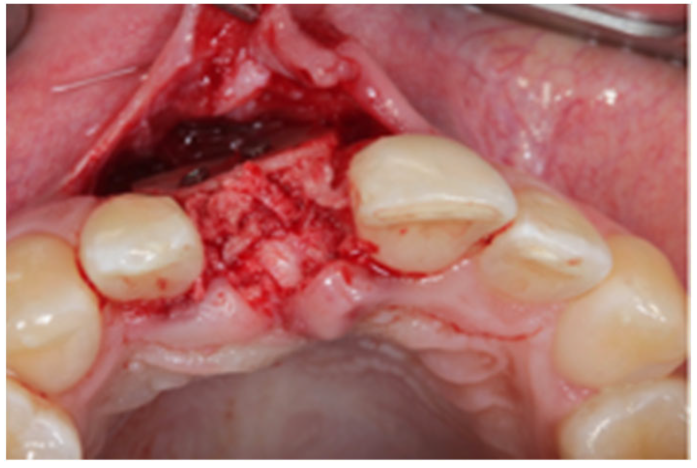 Jcm 12 07013 g004 Jcm 12 07013 g004