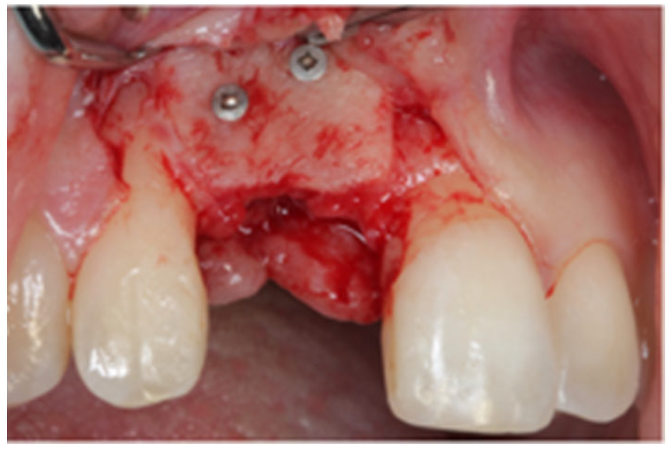 Jcm 12 07013 g006 Jcm 12 07013 g006