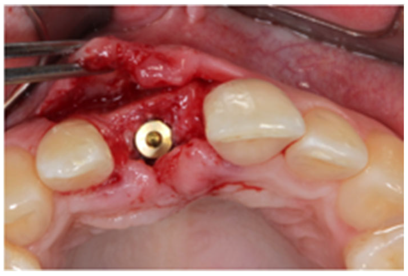 Jcm 12 07013 g007 Jcm 12 07013 g007