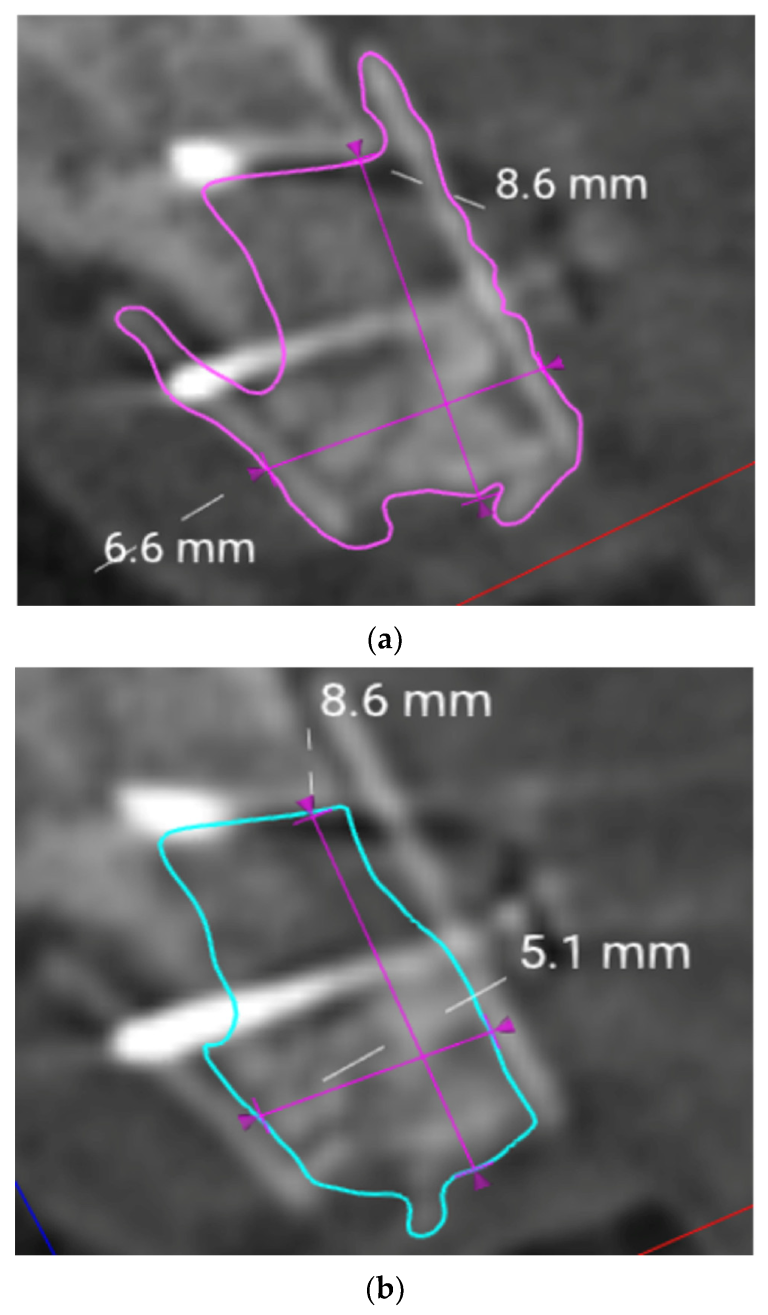 Jcm 12 07013 g013 Jcm 12 07013 g013