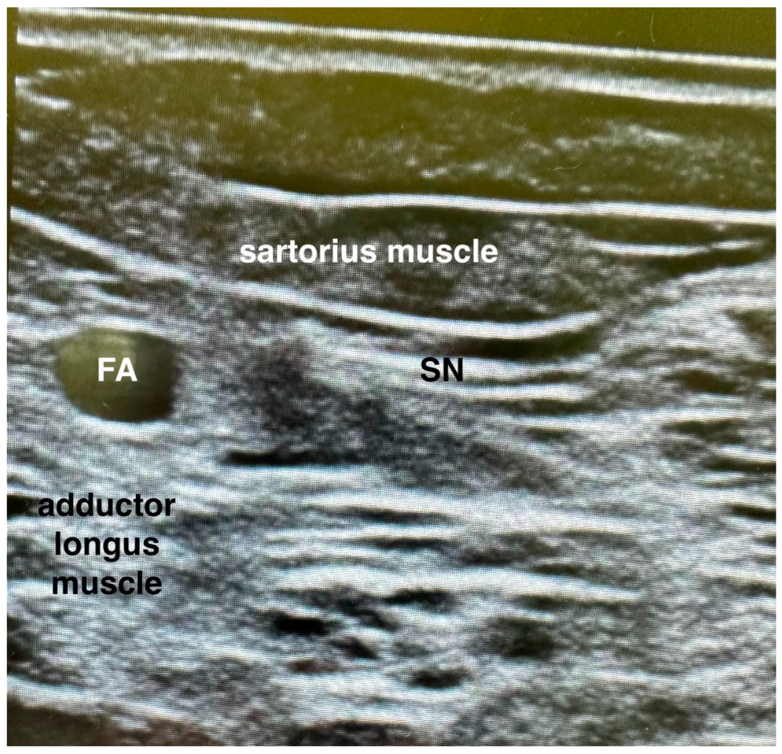 Jcm 12 07088 g002 Jcm 12 07088 g002