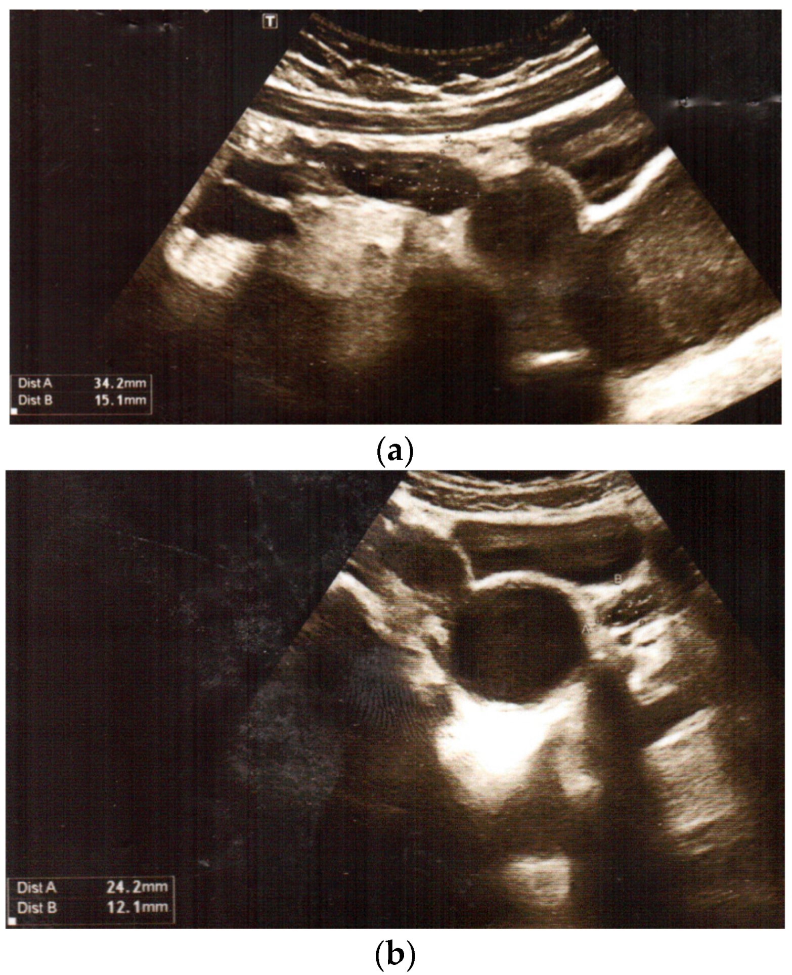 Jcm 12 07284 g001a Jcm 12 07284 g001a