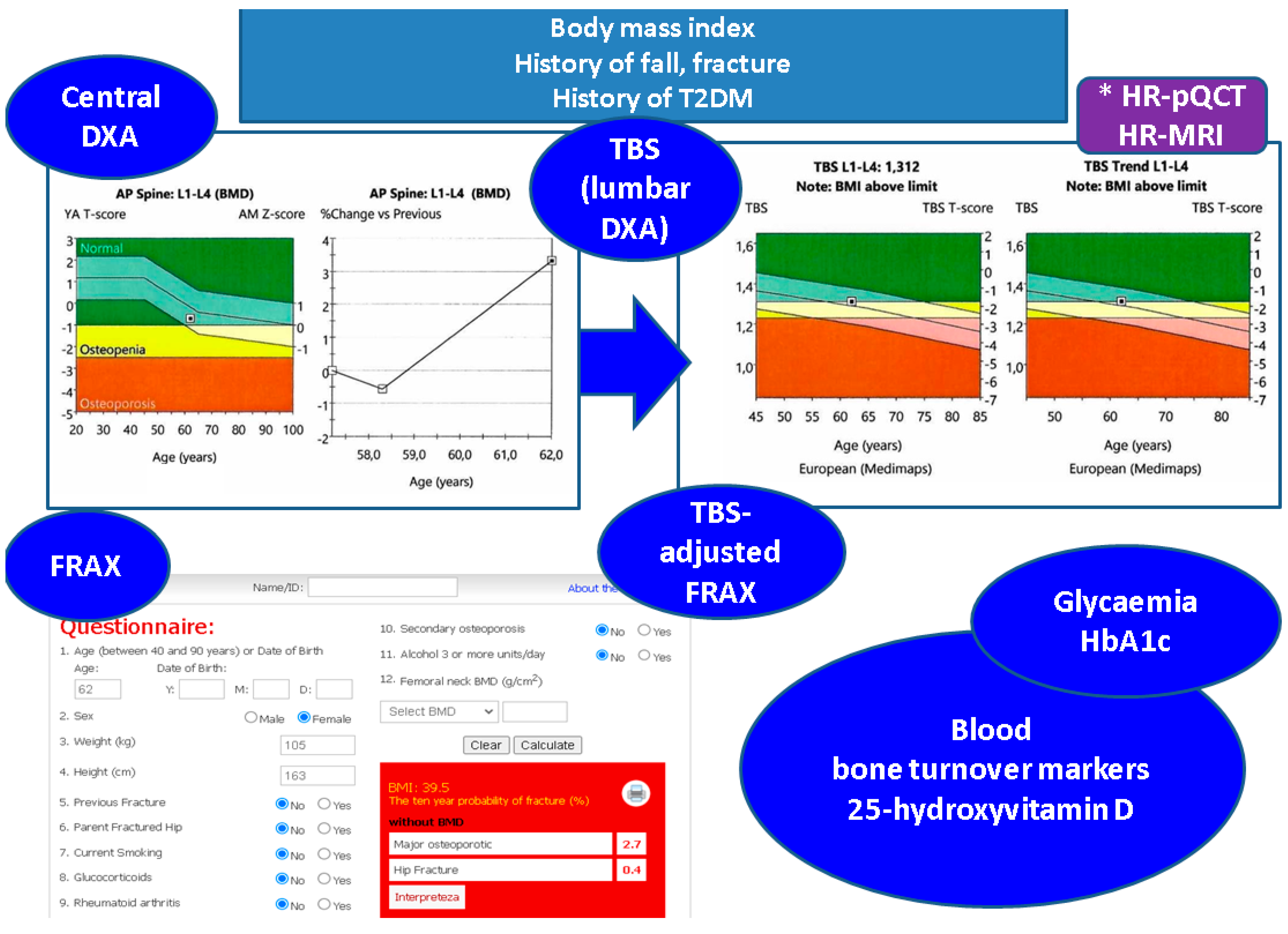 Trabecular Bone Score (TBS) in Individuals with Type 2