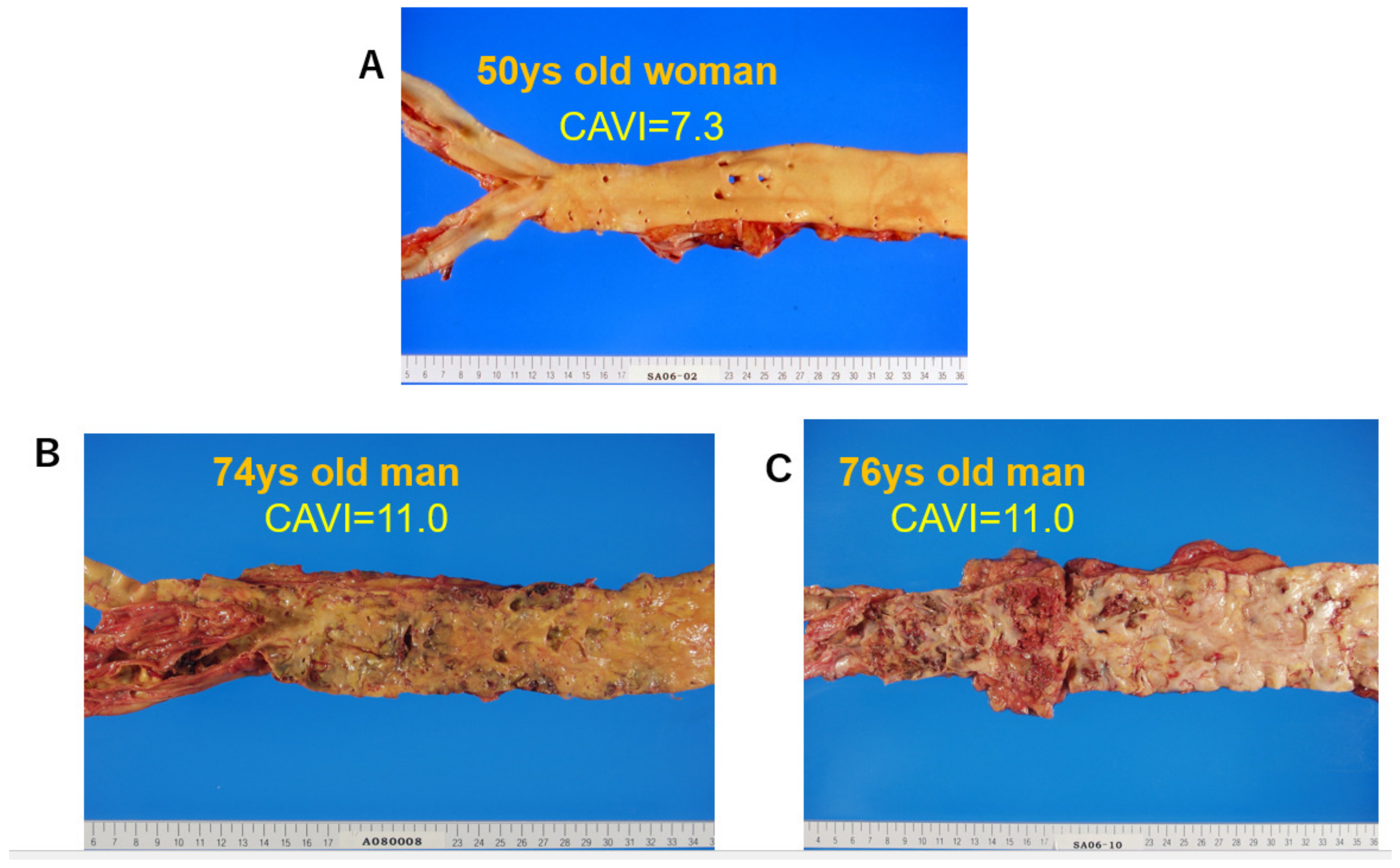 Jcm 12 07436 g005 Jcm 12 07436 g005