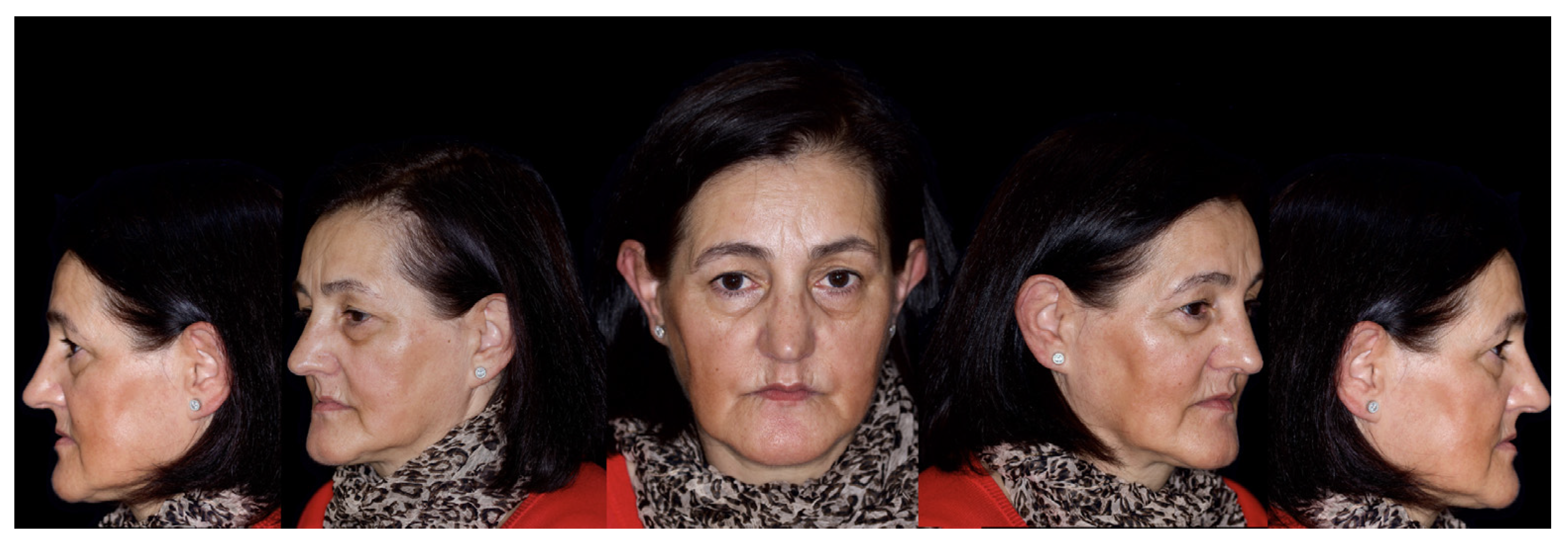 Jcm 12 07464 g002 Jcm 12 07464 g002