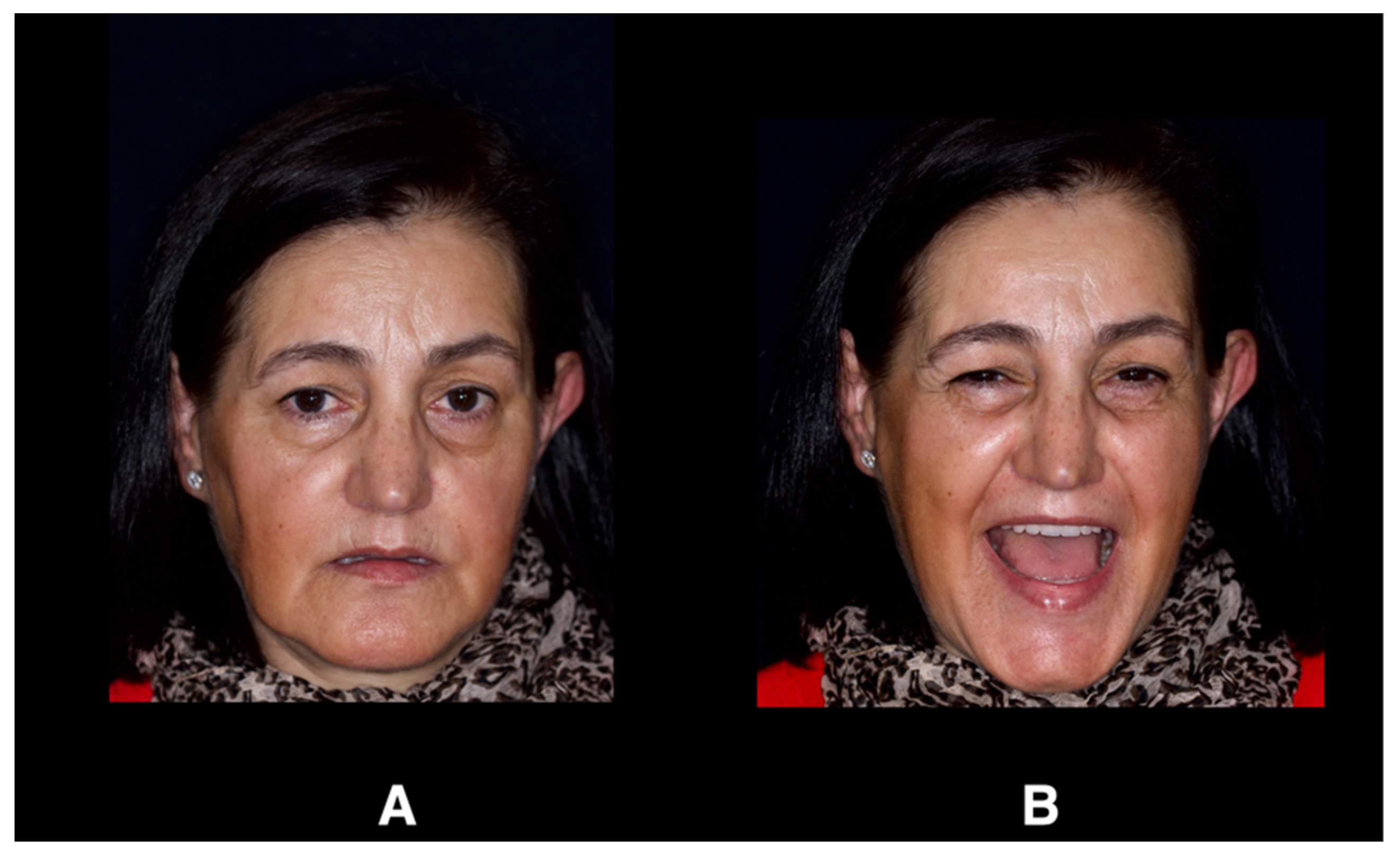 Jcm 12 07464 g003 Jcm 12 07464 g003