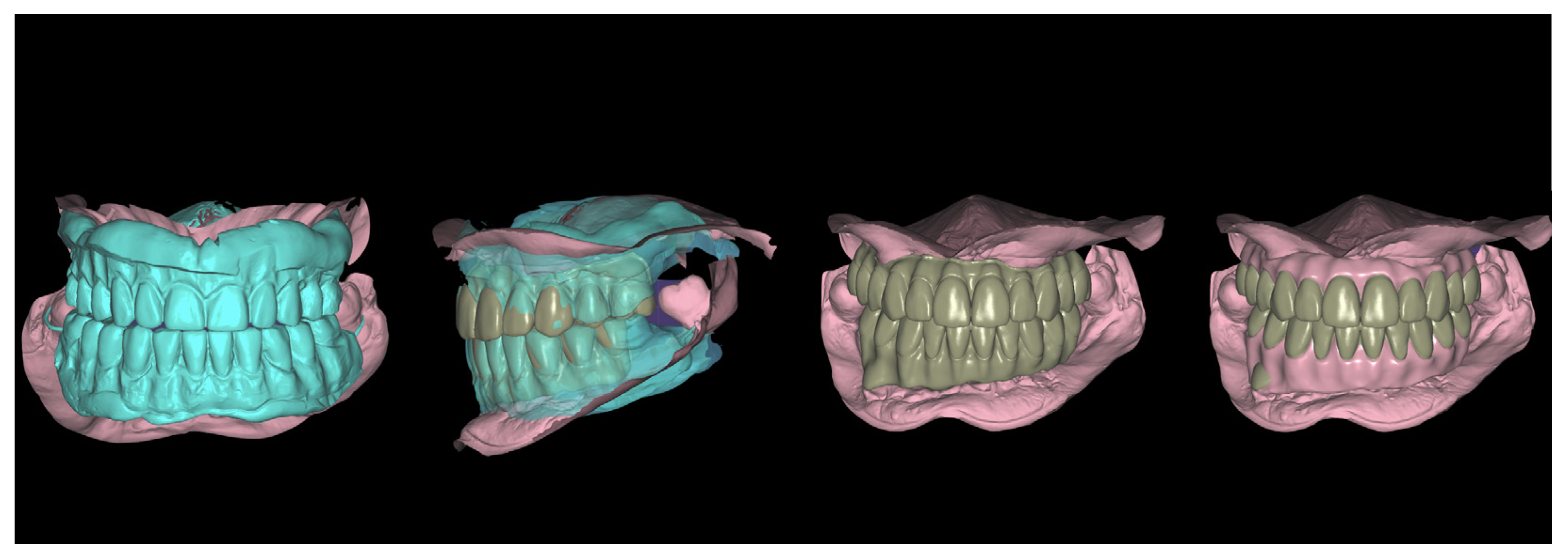 Jcm 12 07464 g004 Jcm 12 07464 g004