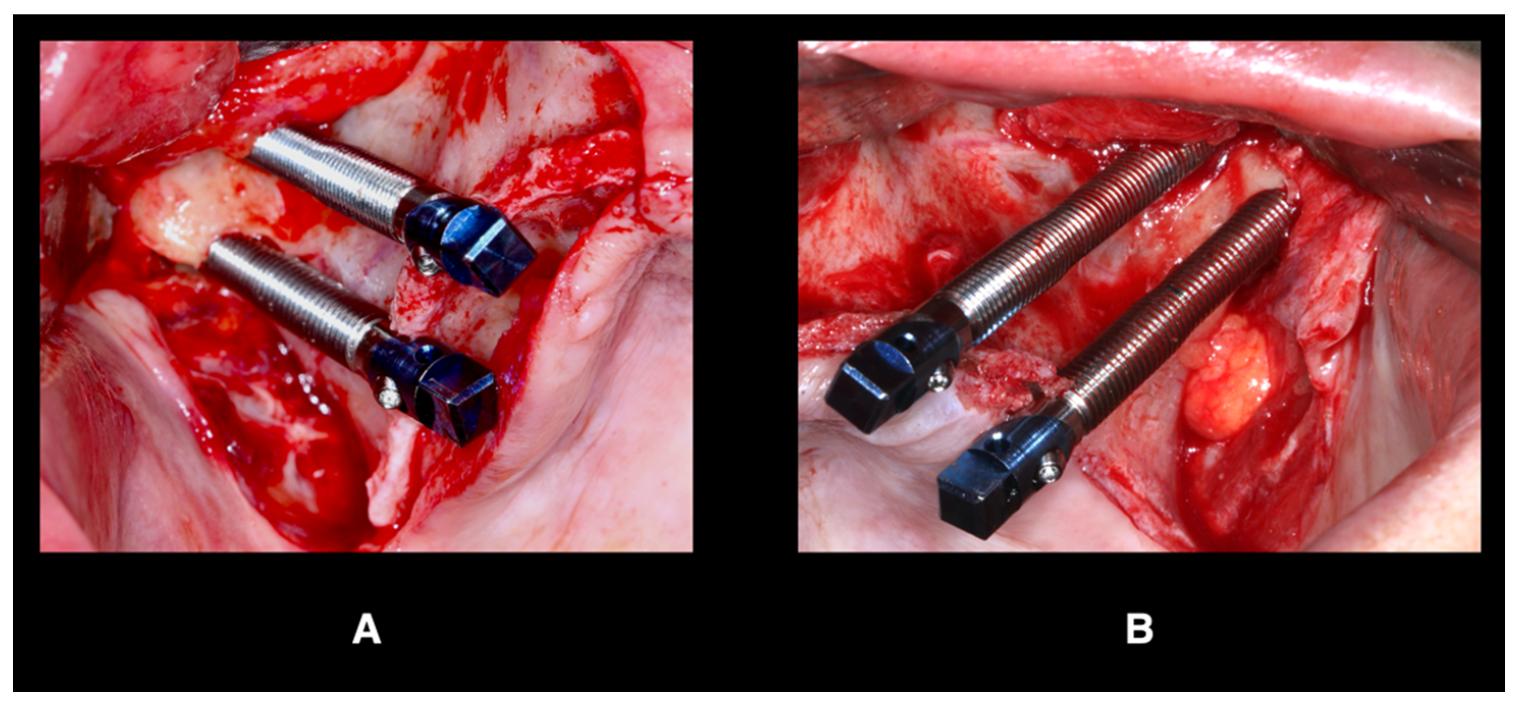 Jcm 12 07464 g005 Jcm 12 07464 g005