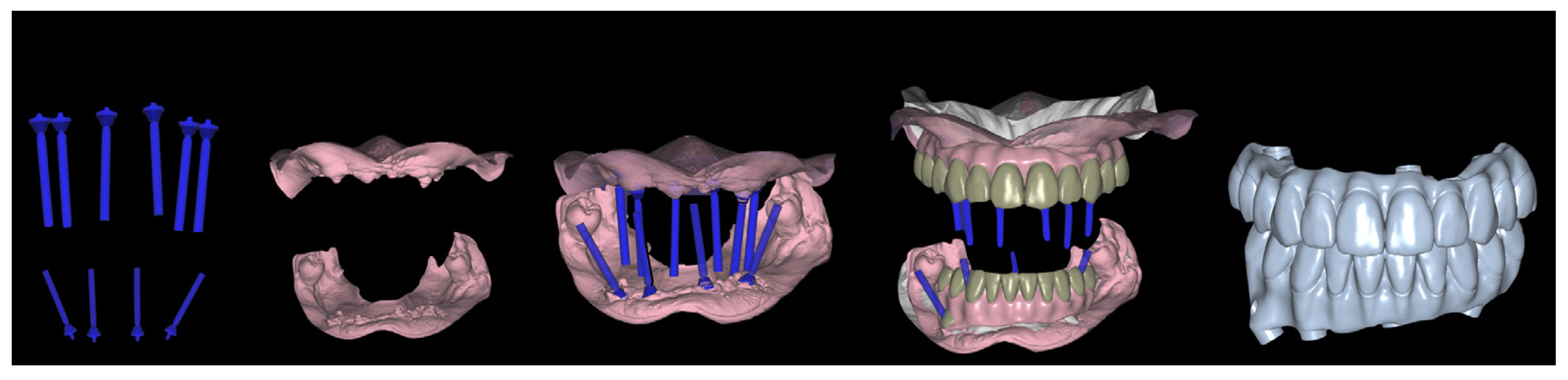 Jcm 12 07464 g007 Jcm 12 07464 g007