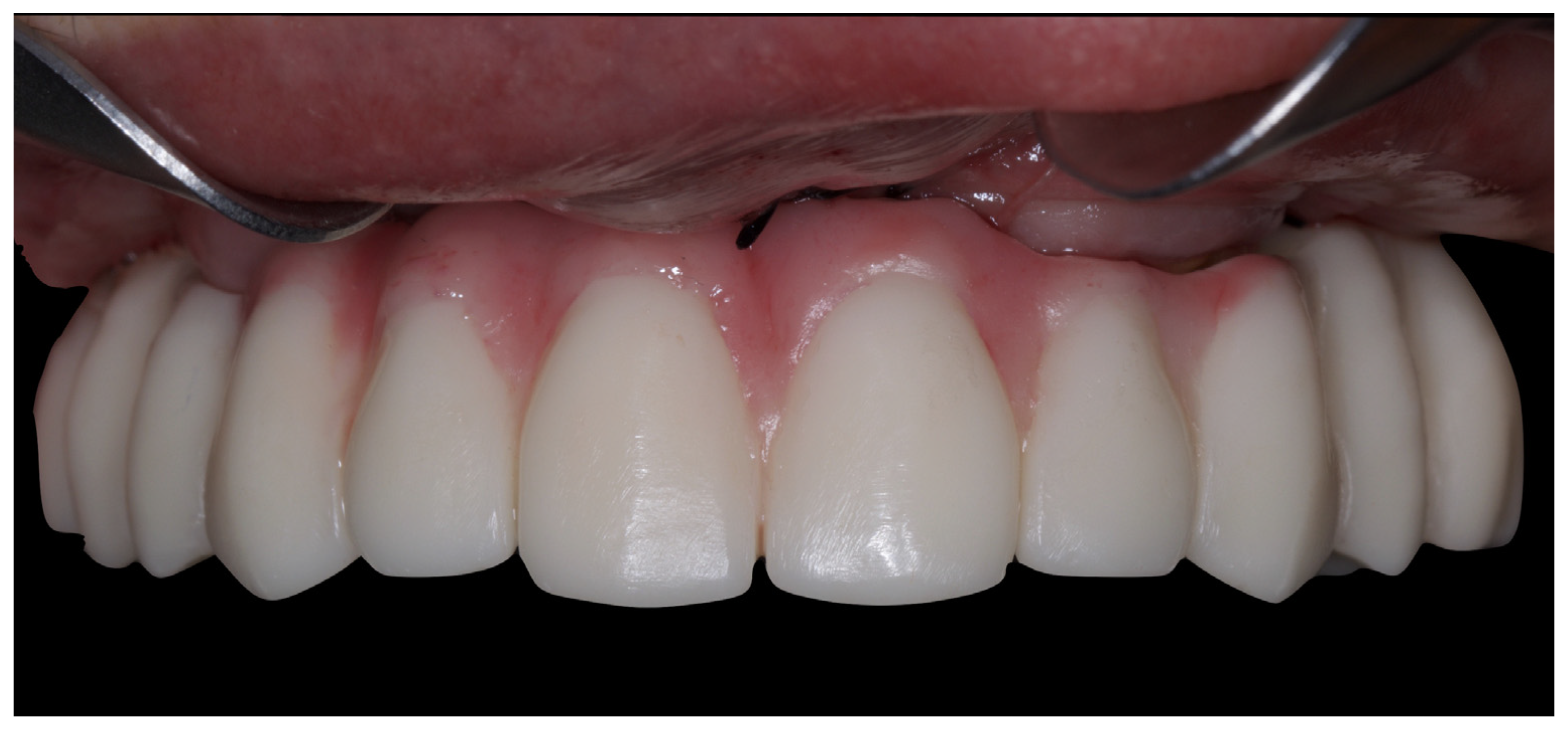 Jcm 12 07464 g009 Jcm 12 07464 g009