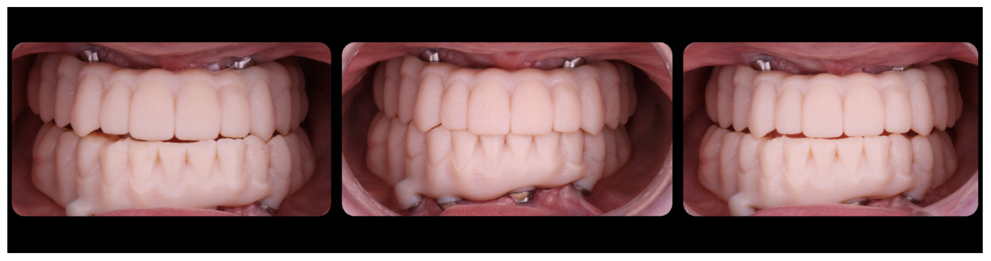 Jcm 12 07464 g013 Jcm 12 07464 g013