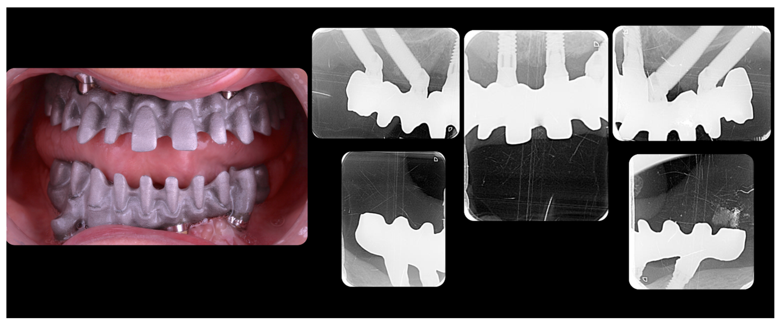 Jcm 12 07464 g014 Jcm 12 07464 g014