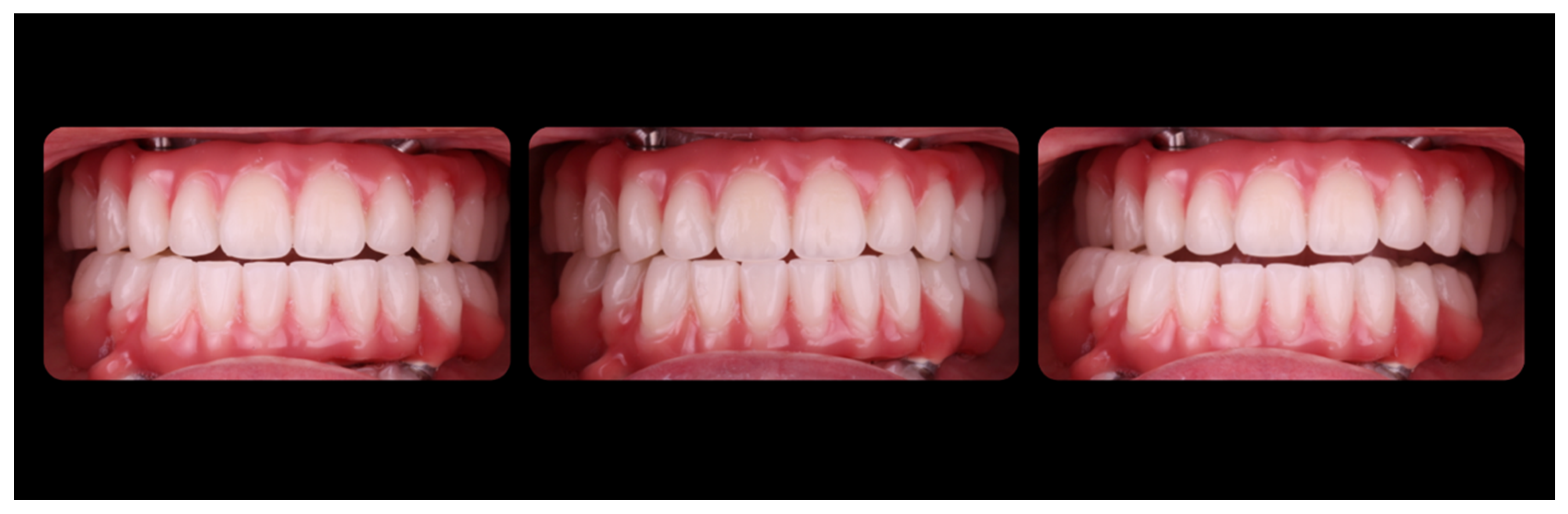 Jcm 12 07464 g015 Jcm 12 07464 g015